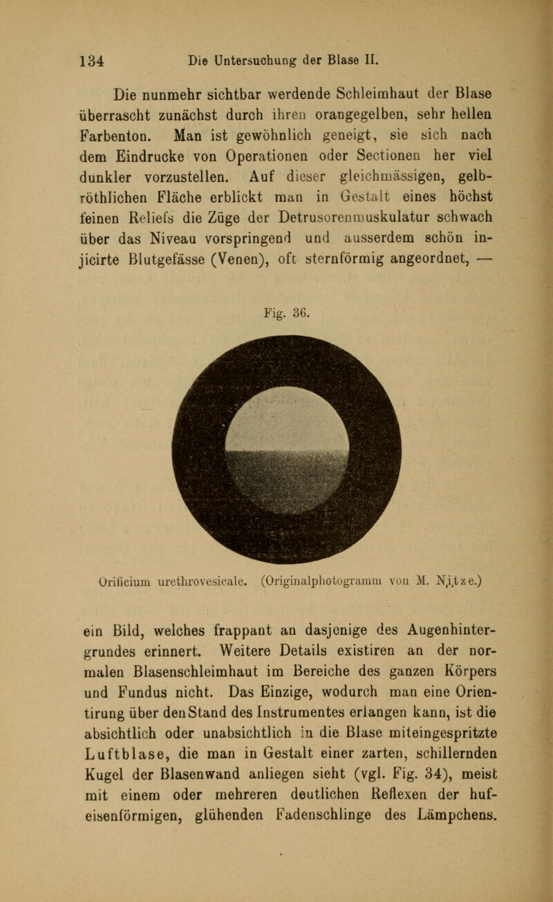 Die nunmehr sichtbar werdende Schleimhaut der Blase überrascht zunächst durch ihren orangegelben, sehr hellen Farbenton. Man ist gewöhnlich geneigt, sie sich nach dem Eindrucke von Operationen oder Sectionen her viel dunkler vorzustellen. Auf dieser gleichmässigen, gelb- röthlichen Fläche erblickt man in Gestalt eines höchst feinen Reliefs die Züge der Detrusorenmuskulatur schwach über das Niveau vorspringend und ausserdem schön in- jicirte Blutgefässe (Venen), oft sternförmig angeordnet,— Fig. 36. Orificium urethrovesicale. (Originalphotogramm von M. N,i,tze.) ein Bild, welches frappant an dasjenige des Augenhinter- grundes erinnert. Weitere Details existiren an der nor- malen Blasenschleimhaut im Bereiche des ganzen Körpers und Fundus nicht. Das Einzige, wodurch man eine Orien- tirung über den Stand des Instrumentes erlangen kann, ist die absichtlich oder unabsichtlich in die Blase miteingespritzte Luftblase, die man in Gestalt einer zarten, schillernden Kugel der Blasenwand anliegen sieht (vgl. Fig. 34), meist mit einem oder mehreren deutlichen Reflexen der huf- eisenförmigen, glühenden Fadenschlinge des Lämpchens.