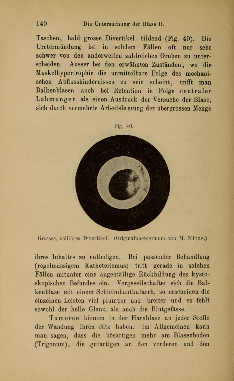 Taschen, bald grosse Divertikel bildend (Fig. 40). Die Uretermündung ist in solchen Fällen oft nur sehr schwer von den anderweiten zahlreichen Gruben zu unter- scheiden. Ausser bei den erwähnten Zuständen, wo die Muskelhypertrophie die unmittelbare Folge des mechani- schen Abflusshindernisses zu sein scheint, trifft man Balkenblasen auch bei Retention in Folge centraler Lähmungen als einen Ausdruck der Versuche der Blase, sich durch vermehrte Arbeitsleistung der übergrossen Menge Fig. 40. Grosses, solitäres Divertikel. (Originalphotogramm von M. Nitze.) ihres Inhaltes zu entledigen. Bei passender Behandlung (regelmässigem Katheterismus) tritt gerade in solchen Fällen mitunter eine augenfällige Rückbildung des kysto- skopischen Befundes ein. Vergesellschaftet sich die Bal- kenblase mit einem Schleimhautkatarrh, so erscheinen die einzelnen Leisten viel plumper und breiter und es fehlt sowohl der helle Glanz, als auch die Blutgefässe. Tumoren können in der Harnblase an jeder Stelle der Wandung ihren Sitz haben. Im Allgemeinen kann man sagen, dass die bösartigen mehr am Blasenboden (Trigonum), die gutartigen an den vorderen und den