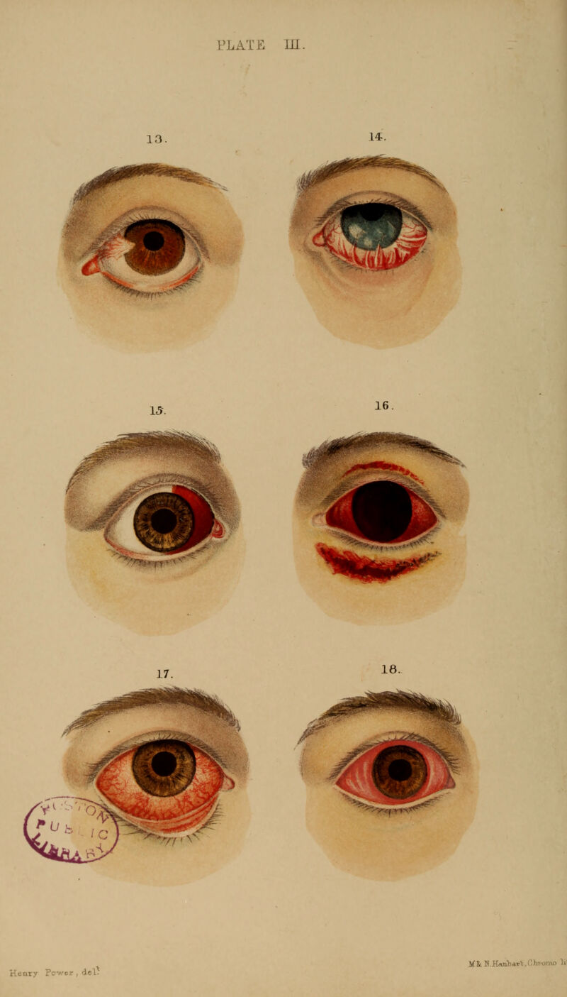 13. L4-. 15. 16 Jmjggm ! * 18. Pcrwor, del* '.