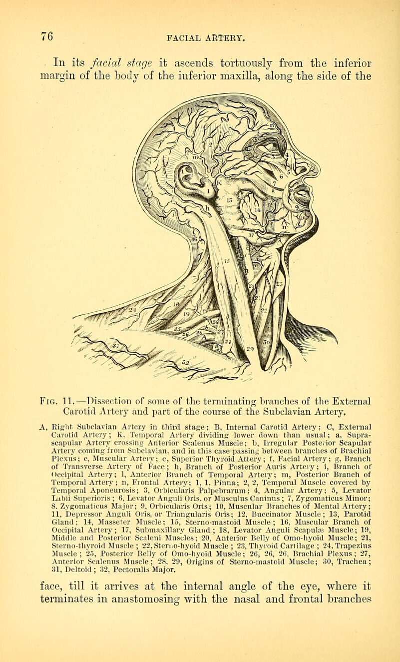 In its facial stage it ascends tortuously from the inferior margin of the body of the inferior maxilla, along the side of the Fig. 11.—Dissection of some of the terminating branches of the External Carotid Artery and part of the course of the Subclavian Artery, A, Right Subclavian Artery in third stage; B, Internal Carotid Artery; C, External Carotid Artery; K, Temporal Artery dividing lower down than usual; a, Supra- scapular Artery crossing Anterior Scalenus Muscle; b, Irregular Posterior Scapular Artery coming from Subclavian, and in this ease passing between branches of Brachial Plexus; c, Muscular Artery; e, Superior Thyroid Attery; f, Facial Artery; g, Branch of Transverse Artery of Face; h, Branch of Posterior Auris Artery; i, Branch of Occipital Artery; 1, Anterior Branch of Temporal Artery; m, Posterior Branch of Temporal Artery; n, Frontal Artery; 1, 1, Pinna; 2, 2, Temporal Muscle covered by Temporal Aponeurosis; 3, Orbicularis Palpebrarum; 4, Angular Artery; 5, Levator Labii Superioris ; 6, Levator Anguli Oris, or Musculus Caninus ; 7, Zygomaticus Minor; 8. Zygomaticus Major; 9, Orbicularis Oris; 10, Muscular Branches of Mental Artery; 11, Depressor Anguli Oris, or Triangularis Oris; 12, Buccinator Muscle; 13, Parotid Gland; 14, Masseter Muscle; 15, Sterno-mastoid Muscle ; 16, Muscular Branch of Occipital Artery; 17, Submaxillary Gland; 18, Levator Anguli Scapulas Muscle; 19, Middle and Posterior Scaleni Muscles; 20, Anterior Belly of Omo-hyoid Muscle; 21, Sterno-thyroid Muscle ; 22, Sterno-hyoid Muscle ; 23, Thyroid Cartilage ; 24, Trapezius Muscle; 25, Posterior Belly of Omo-hyoid Muscle; 26, 26, 26, Brachial Plexus; 27, Anterior Scalenus Muscle; 28, 29, Origins of Sterno-mastoid Muscle; 30, Trachea; 31, Deltoid ; 32, Pectoralis Major. face, till it arrives at the internal angle of the eye, where it terminates in anastomosing with the nasal and frontal branches