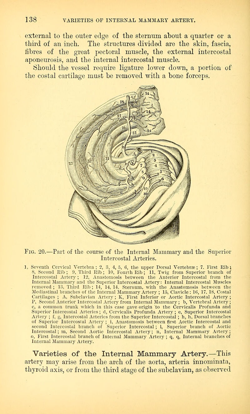 external to the outer edge of the sternum about a quarter or a third of an inch. The structures divided are the skin, fascia, fibres of the great pectoral muscle, the external intercostal aponeurosis, and the internal intercostal muscle. Should the vessel require ligature lower down, a portion of the costal cartilage must be removed with a bone forceps. Fig. 20.—Part of the course of the Internal Mammary and the Superior Intercostal Arteries. 1, Seventh Cervical Vertebra; 2, 3, 4, 5, 6, the upper Dorsal Vertebra?; 7. First Rib; S, Second Rib; 9, Third Rib; 10, Fourth Rib; 11, Twig from Superior branch of Intercostal Artery ; 12, Anastomosis between the Anterior Intercostal from the Internal Mammary and the Superior Intercostal Artery: Internal Intercostal Muscles removed ; 13, Third Rib; 14, 14, 14, Sternum, with the Anastomosis between the Mediastinal branches of the Internal Mammary Artery ; 15, Clavicle: 16, 17, IS, Costal Cartilages ; A, Subclavian Artery; K, First Inferior or Aortic Intercostal Artery ; P, Second Anterior Intercostal Artery from Internal Mammary; b, Vertebral Artery; c, a common trunk which in this case gave origin to the Cervicalis Profunda and Superior Intercostal Arteries; d, Cervicalis Profunda Artery; e, Superior Intercostal Artery ; f, g, Intercostal Arteries from the Superior Intercostal; h, h, Dorsal branches of Superior Intercostal Artery ; i, Anastomosis between first Aortic Intercostal and second Intercostal branch of Superior Intercostal; 1, Superior branch of Aortic Intercostal; m, Second Aortic Intercostal Artery; n, Internal Mammary Artery; o, First Intercostal branch of Internal Mammary Artery ; q, q, Internal branches of Internal Mammary Artery. Varieties of the Internal Mammary Artery.—This artery may arise from the arch of the aorta, arteria innominata, thyroid axis, or from the third stage of the subclavian, as observed