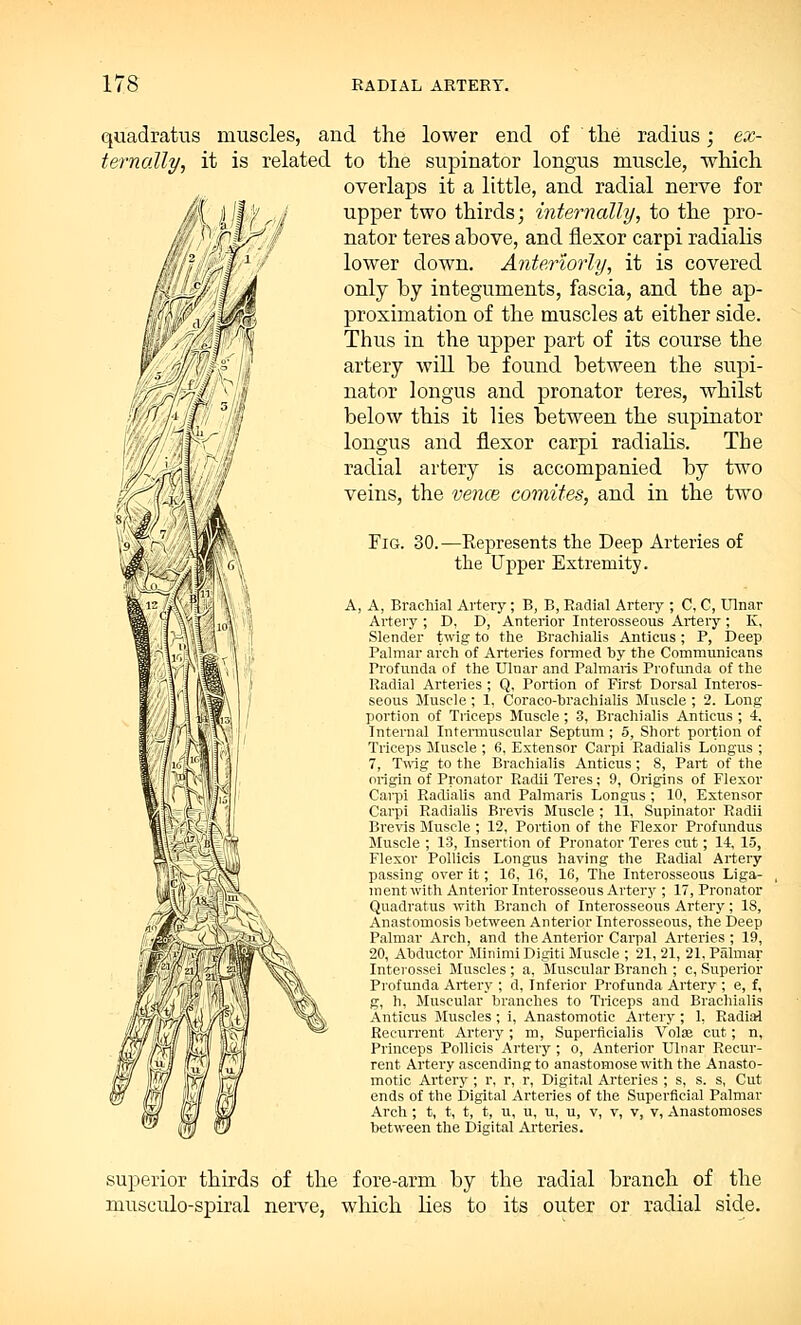 quadratus muscles, and the lower end of the radius; ex- ternally, it is related to the supinator longus muscle, which overlaps it a little, and radial nerve for upper two thirds; internally, to the pro- nator teres ahove, and flexor carpi radialis lower clown. Anteriorly, it is covered only hy integuments, fascia, and the ap- proximation of the muscles at either side. Thus in the upper part of its course the artery will be found between the supi- nator longus and pronator teres, whilst below this it lies between the supinator longus and flexor carpi radialis. The radial artery is accompanied by two veins, the vence comites, and in the two Fig. 30.—Represents the Deep Arteries of the Upper Extremity. , A, Brachial Artery; B, B, Radial Artery ; C, C, Ulnar Artery ; D, D, Anterior Interosseous Artery ; K, Slender twig to the Brachialis Anticus; P, Deep Palmar arch of Arteries formed by the Communicans Profunda of the Ulnar and Palmaris Profunda of the Radial Arteries ; Q, Portion of First Dorsal Interos- seous Muscle ; 1, Coraco-brachialis Muscle ; 2. Long portion of Tiiceps Muscle ; 3, Brachialis Anticus ; 4. Internal Intermuscular Septum ; 5, Short portion of Triceps Muscle ; 6, Extensor Carpi Radialis Longus ; 7, Twig to the Brachialis Anticus; 8, Part of the origin of Pronator Radii Teres; 9, Origins of Flexor Carpi Radialis and Palmaris Longus ; 10, Extensor Carpi Radialis Brevis Muscle; 11, Supinator Radii Brevis Muscle ; 12, Portion of the Flexor Profundus Muscle ; 13, Insertion of Pronator Teres cut; 14, 15, Flexor Pollicis Longus having the Radial Artery passing over it; 16, 16, 16, The Interosseous Liga- ment with Anterior Interosseous Artery ; 17, Pronator Quadratus with Branch of Interosseous Artery; IS, Anastomosis between Anterior Interosseous, the Deep Palmar Arch, and the Anterior Carpal Arteries ; 19, 20, Abductor Minimi Digiti Muscle ; 21, 21, 21, Palmar Intei-ossei Muscles ; a, Muscular Branch ; c, Superior Profunda Artery ; d, Inferior Profunda Artery ; e, f, g, h, Muscular branches to Triceps and Brachialis Anticus Muscles ; i, Anastomotic Artery ; 1. Radial Recurrent Artery; m, Superficialis Volae cut; n, Princeps Pollicis Artery ; o, Anterior Ulnar Recur- rent Artery ascending to anastomose with the Anasto- motic Artery ; r, r, r, Digital Arteries ; s, s. s, Cut ends of the Digital Arteries of the Superficial Palmar Arch ; t, t, t, t, u, u, u, u, v, v, v, v, Anastomoses between the Digital Arteries. superior thirds of the fore-arm by the radial branch of the musculo-spiral nerve, which lies to its outer or radial side.