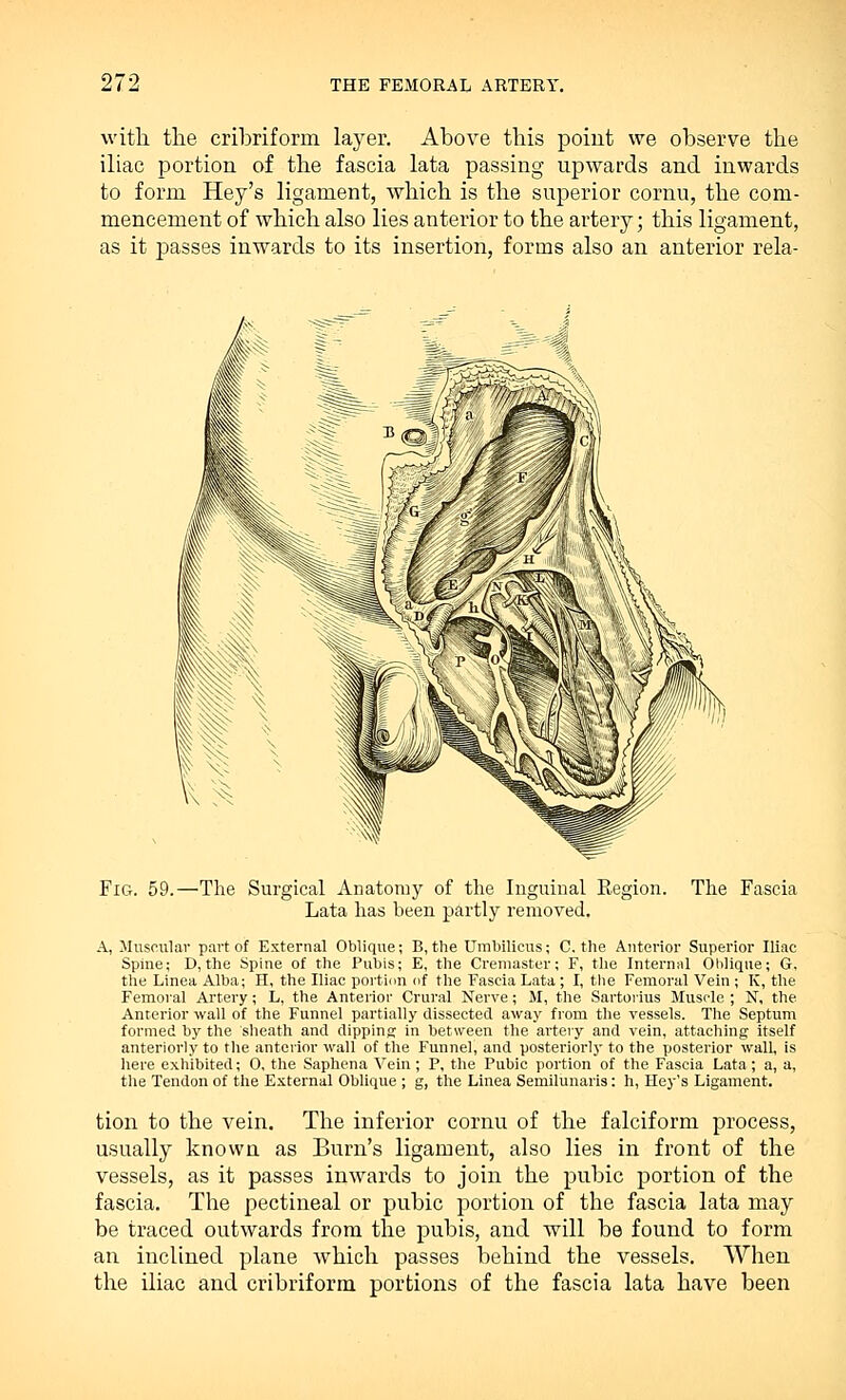 with the cribriform layer. Above this point we observe the iliac portion of the fascia lata passing upwards and inwards to form Hey's ligament, which is the superior cornu, the com- mencement of which also lies anterior to the artery • this ligament, as it passes inwards to its insertion, forms also an anterior rela- FiG. 59.—The Surgical Anatomy of the Inguinal Region. The Fascia Lata has been partly removed. A, Muscular part of External Oblique; B,the Umbilicus; C. the Anterior Superior Iliac Spine; D, the Spine of the Pubis; E, the Cremaster; F, the Internal Oblique; G, the Linea Alba; H, the Iliac portion of the Fascia Lata; I, the Femoral Vein ; K, the Femoral Artery; L, the Anterior Crural Nerve; M, the Sartoiius Muscle ; N, the Anterior wall of the Funnel partially dissected away from the vessels. The Septum formed by the 'sheath and dipping in between the artery and vein, attaching itself anteriorly to the anterior wall of the Funnel, and posteriorly to the posterior wall, is here exhibited; 0, the Saphena Vein ; P, the Pubic portion of the Fascia Lata; a, a, the Tendon of the External Oblique ; g, the Linea Semilunaris: h, Hey's Ligament. tion to the vein. The inferior cornu of the falciform process, usually known as Burn's ligament, also lies in front of the vessels, as it passes inwards to join the pubic portion of the fascia. The pectineal or pubic portion of the fascia lata may be traced outwards from the pubis, and will be found to form an inclined plane which passes behind the vessels. When the iliac and cribriform portions of the fascia lata have been