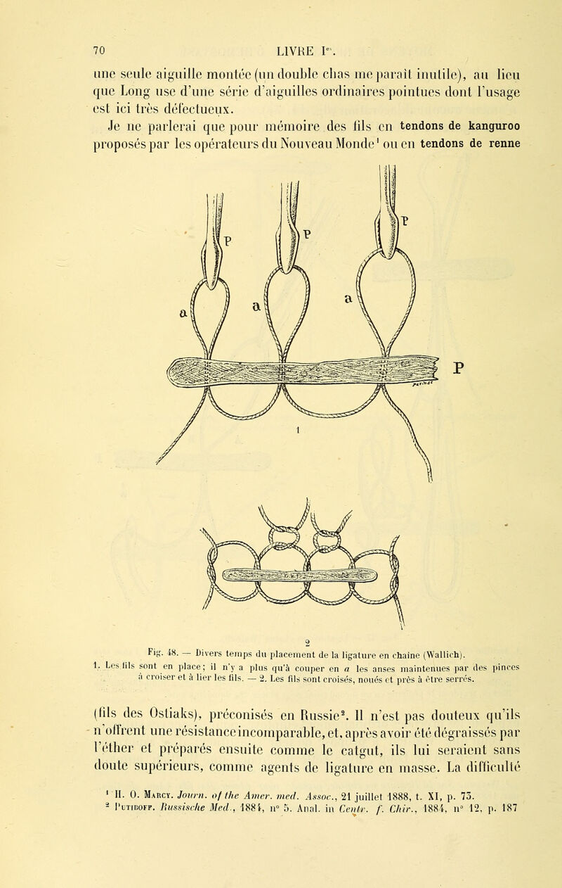 une seule aiguille montée (un double chas me parait inutile), au lieu que Long use d'une série d'aiguilles ordinaires pointues dont l'usage est ici très défectueux. Je ne parlerai que pour mémoire des fils en tendons de kanguroo proposés par les opérateurs du Nouveau Monde1 ou en tendons de renne Fig. 48. — Divers temps du placement de la ligature en chaîne (Wallich). 1. Les fils sont en place; il n'y a plus qu'à couper en a les anses maintenues par des pinces 2. Les fils sont croisés, noués et près à être serrés. à croiser et à lier les lils. (fils des Ostiaks), préconisés en Russie2. 11 n'est pas douteux qu'ils n'offrent une résistance incomparable, et, après avoir été dégraissés par l'éther et préparés ensuite comme le catgut, ils lui seraient sans doute supérieurs, comme agents de ligature en masse. La difficulté 1 H. 0. Maucy. Journ. ofthe Amer. med. Âssoc, 21 juillet. 1888, t. XI, p. 73. 2 I'utiboff. Bussiscke Med.. 188i, n° 5. Anal, in Ccnlr. f. Chir., 1884, n° 12, p. 187