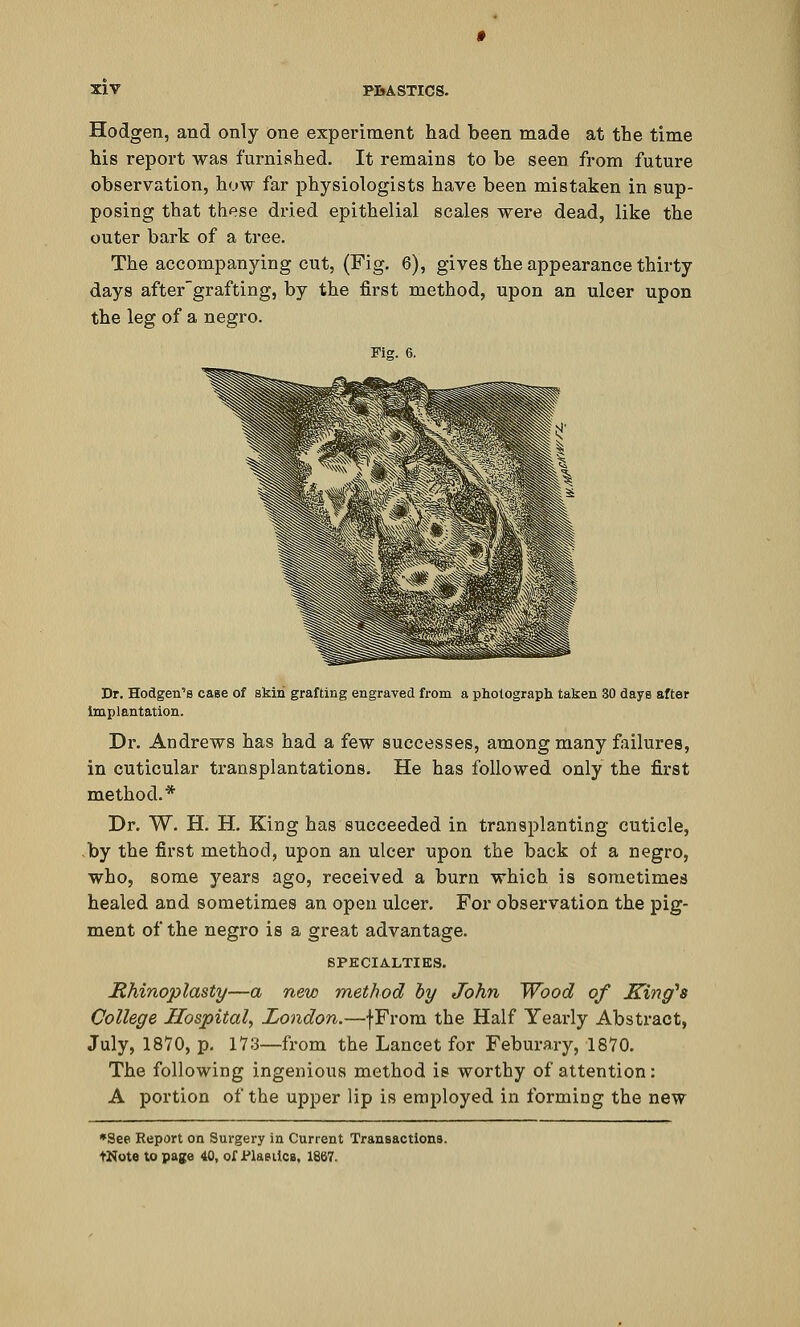 Hodgen, and only one experiment had been made at the time his report was furnished. It remains to be seen from future observation, how far physiologists have been mistaken in sup- posing that these dried epithelial scales were dead, like the outer bark of a tree. The accompanying cut, (Fig. 6), gives the appearance thirty days after'grafting, by the first method, upon an ulcer upon the leg of a negro. Fig. 6. Dr. Hodgen's case of skin grafting engraved from a photograph taken 30 days after implantation. Dr. Andrews has had a few successes, among many failures, in cuticular transplantations. He has followed only the first method.* Dr. W. H. H. King has succeeded in transplanting cuticle, by the first method, upon an ulcer upon the back of a negro, who, some years ago, received a burn which is sometimes healed and sometimes an open ulcer. For observation the pig- ment of the negro is a great advantage. SPECIALTIES. Rhinoplasty—a new method by John Wood of King's College Hospital, London.—fFrom the Half Yearly Abstract, July, 1870, p. 173—from the Lancet for Feburary, 1870. The following ingenious method is worthy of attention: A portion of the upper lip is employed in forming the new •See Report on Surgery in Current Transactions. tNote to page 40, of JPlasiics. 1867.