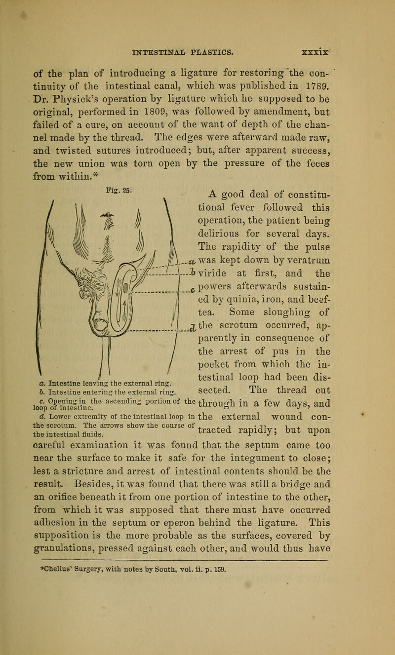 of the plan of introducing a ligature for restoring the con- tinuity of the intestinal canal, which was published in 1789. Dr. Physick's operation by ligature which he supposed to be original, performed in 1809, was followed by amendment, but failed of a cure, on account of the want of depth of the chan- nel made by the thread. The edges were afterward made raw, and twisted sutures introduced; but, after apparent success, the new union was torn open by the pressure of the feces from within.* A good deal of constitu- tional fever followed this operation, the patient being delirious for several days. The rapidity of the pulse </^# fl\-—a'was kept; down by veratrum b viride at first, and the 0 powers afterwards sustain- ed by quinia, iron, and beef- tea. Some sloughing of 3, the scrotum occurred, ap- parently in consequence of the arrest of pus in the pocket from which the in- testinal loop had been dis- sected. The thread cut loo °?eini,Setlie ascending portion of the through in a few days, and d. Lower extremity of the intestinal loop in the external WOUnd COn- the scrotum. The arrows show the course of , , -, • -n i j. the intestinal fluids. tracted rapidly; but upon careful examination it was found that the septum came too near the surface to make it safe for the integument to close; lest a stricture and arrest of intestinal contents should be the result. Besides, it was found that there was still a bridge and an orifice beneath it from one portion of intestine to the other, from which it was supposed that there must have occurred adhesion in the septum or eperon behind the ligature. This supposition is the more probable as the surfaces, covered by granulations, pressed against each other, and would thus have a. Intestine leaving the external ring. b. Intestine entering the external rin< *Chelius' Surgery, with notes by South, vol. ii. p. 159.