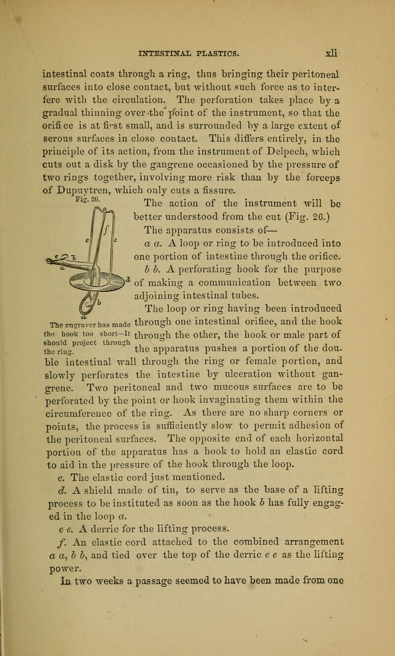 intestinal coats through a ring, thus bringing their peritoneal surfaces into close contact, but without such force as to inter- fere with the circulation. The perforation takes place by a gradual thinning over-the p'bint of the instrument, so that the orifice is at fi'-st small, and is surrounded by a large extent of serous surfaces in close contact. This differs entirely, in the principle of its action, from the instrument of Delpech, which cuts out a disk by the gangrene occasioned by the pressure of two rings together, involving more risk than by the forceps of Dupuytren, which only cuts a fissure. The action of the instrument will be better understood from the cut (Fig. 26.) The apparatus consists of— a a. A loop or ring to be introduced into one portion of intestine through the orifice. b b. A perforating hook for the purpose )3 of making a communication between two adjoining intestinal tubes. The loop or ring having been introduced The engraver has made through one intestinal orifice, and the hook the hook too short-it through the other, the hook or male part of 6hould project through . „ . . the ria„ the apparatus pushes a portion 01 the clou, ble intestinal wall through the ring or female portion, and slowly perforates the intestine by ulceration without gan- grene. Two peritoneal and two mucous surfaces are to be perforated by the point or hook invaginating them within the circumference of the ring. As there are no sharp corners or points, the process is sufficiently slow to permit adhesion of the peritoneal surfaces. The opposite end of each horizontal portion of the apparatus has a hook to hold an elastic cord to aid in the pressure of the hook through the loop. c. The elastic cord just mentioned. d. A shield made of tin, to serve as the base of a lifting process to be instituted as soon as the hook b has fully engag- ed in the loop a. e e. A derric for the lifting process. /. An elastic cord attached to the combined arrangement a a, b b, and tied over the top of the derric e e as the lifting power. In two weeks a passage seemed to have been made from one