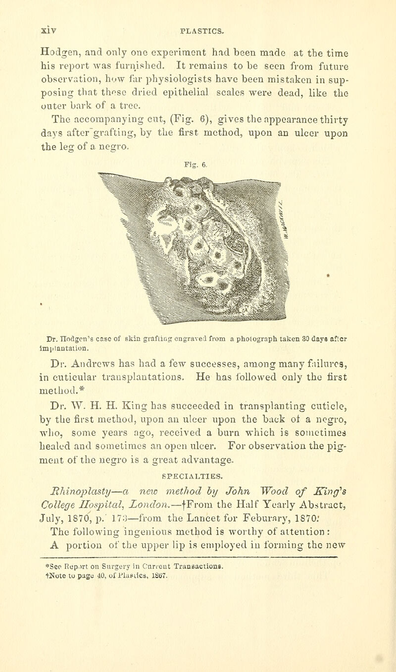 Hodgen, and only one exporiraont had been made at the time his report was furnished. It remains to be seen from future observation, how far physiologists have been mistaken in sup- posing that those dried epithelial scales were dead, like the outer bark of a tree. The accompanying cut, (Fig. 6), gives the appearance thirty days after^grafting, by the first method, upon an ulcer upon the leg of a negro. Dr. nodgcn's case of skin grafling engraved from a photograph taken 30 days aflcr imiilantaiion. Dr. Andrews has had a few successes, among many failures, in cuticular transplantations. He has followed only the first method.* Dr. W. H. H. King has succeeded in transplanting cuticle, by the first method, upon an ulcer upon the back ot a negro, who, some years ago, received a burn which is sometimes healed and sometimes an open ulcer. For observation the pig- ment of the negro is a great advantage. SPECIALTIES. Mhinojylasty—a new method by John Wood of King's College Hospital^ London.—fFrom the Half Yearly Abstract, July, 1870, p.' l7o—from the Lancet for Feburary, 1870.' The following ingenious method is worthy of attention: A portion of the upper lip is employed in forming the new *Sep Rep.irt on Surgery in Ciiricut Transactions. tNote to pagu 40, of WuBiics, 1867.