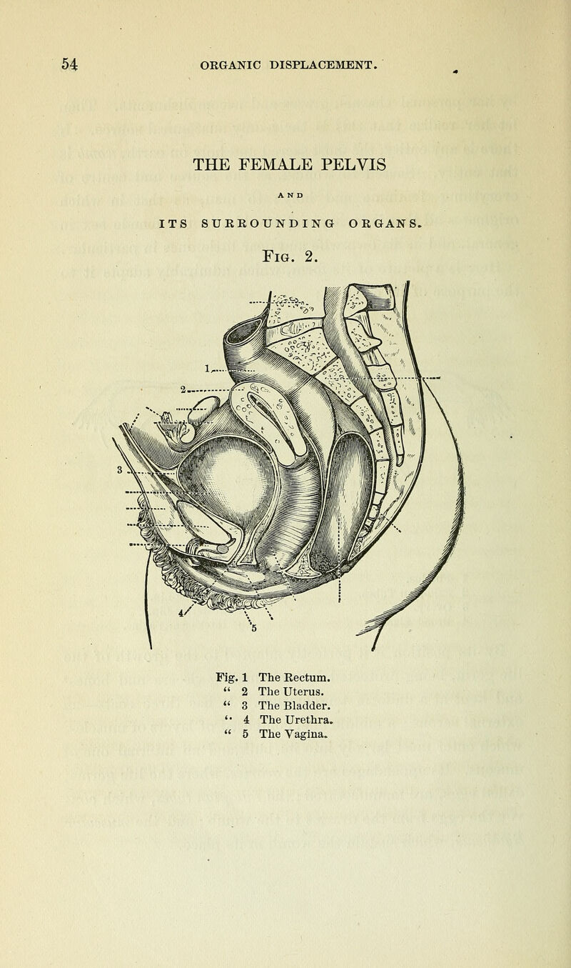 THE FEMALE PELVIS AND its surrounding organs. Fig. 2. Fig. 1 The Rectum.  2 The Uterus.  3 The Bladder. '• 4 The Urethra,  5 The Vagina.