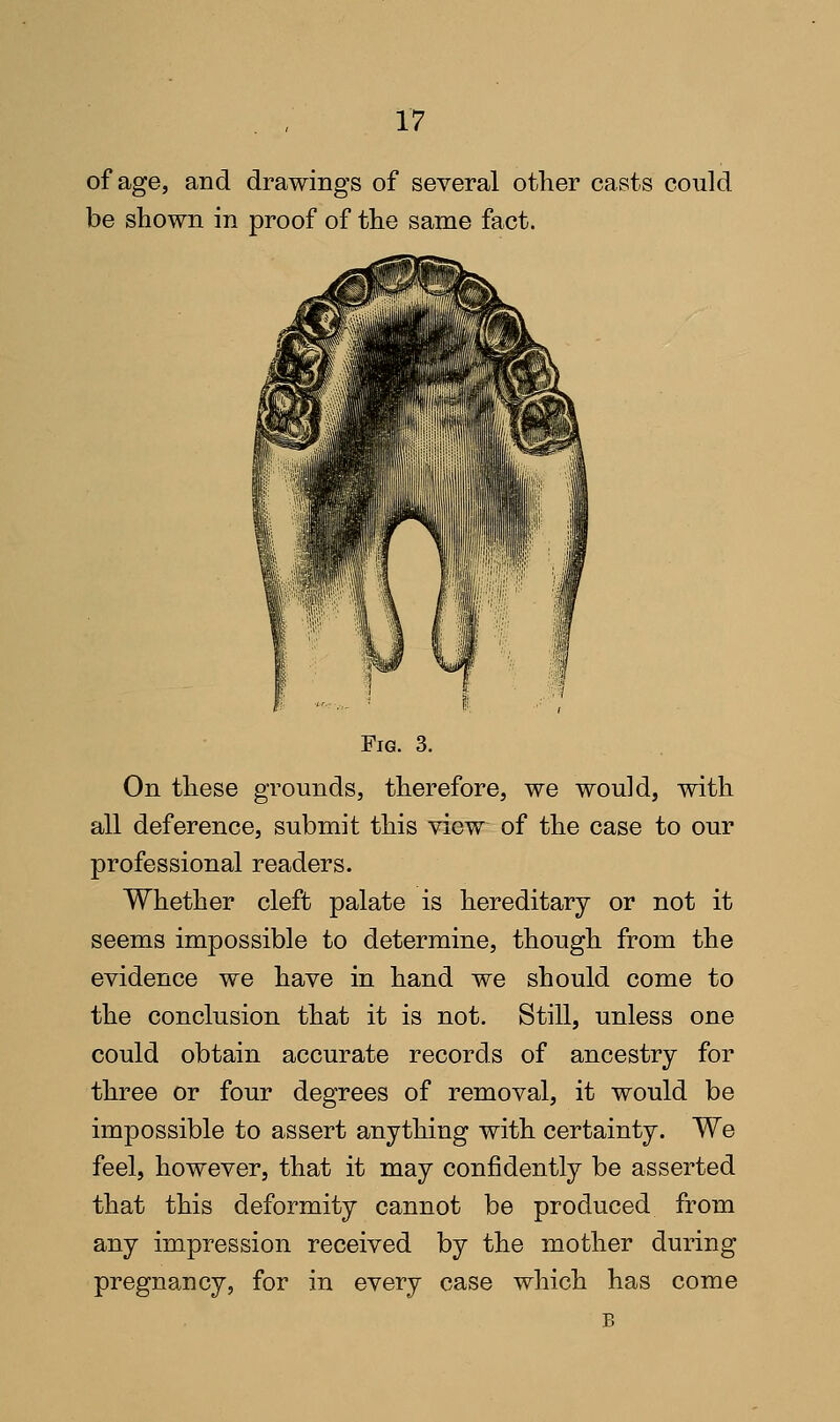 of age, and drawings of several other casts could be shown in proof of the same fact. Fig. 3. On these grounds, therefore, we would, with all deference, submit this view of the case to our professional readers. Whether cleft palate is hereditary or not it seems impossible to determine, though from the evidence we have in hand we should come to the conclusion that it is not. Still, unless one could obtain accurate records of ancestry for three or four degrees of removal, it would be impossible to assert anything with certainty. We feel, however, that it may confidently be asserted that this deformity cannot be produced from any impression received by the mother during pregnancy, for in every case which has come B