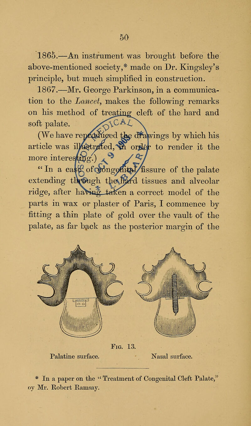 60 186^.—An instrument was brought before tbe above-mentioned society,* made on Dr. Kingsley's principle, but much simplified in construction. 1867.—^Mr. Greorge Parkinson, in a communica- tion to tbe Lancet, makes the following remarks on liis method of trealins: cleft of the hard and soft palate. rings by which his orgLM to render it the (We have re article was more intere *'In a cal^of<r^ngeffi:<^X/fissure of the palate extending to^^^gh the^Mfd tissues and alveolar ridge, after haHag_-ta:^n a correct model of the parts in wax or plaster of Paris, I commence by fitting a thin plate af gold over the vault of the palate, as far back as the posterior margin of the Fig. 13. Palatine surface. Nasal surface. * In a paper on the  Treatment of Congenital Cleft Palate, oy Mr. Robert Ramsaj^