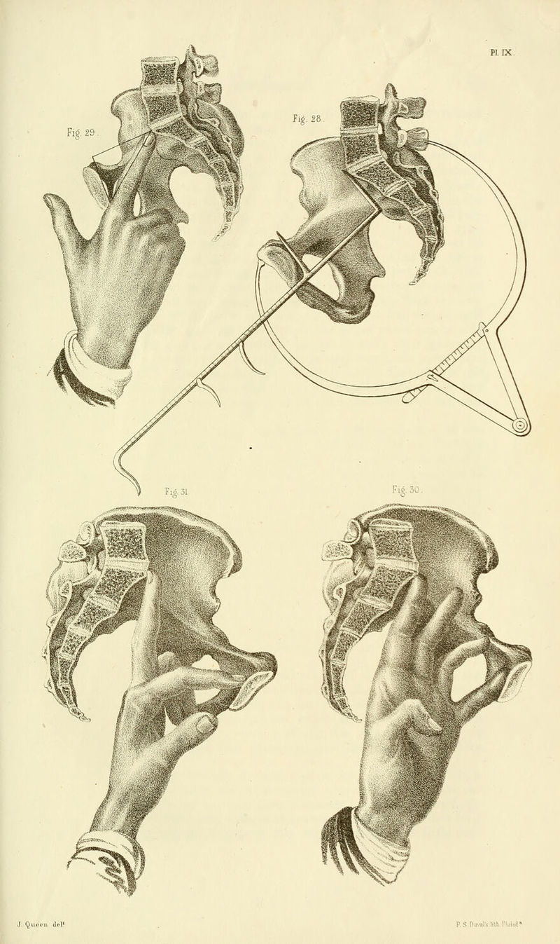 PL IX Fig. 29 J. Queer del! !
