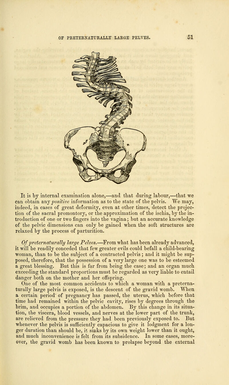 It is by internal examination alone,—and that during labour,—that we can obtain any positive information as to the state of the pelvis. We may, indeed, in cases of great deformity, even at other times, detect the projec- tion of the sacral promontory, or the approximation of the ischia, by the in- troduction of one or two fingers into the vagina; but an accurate knowledge of the pelvic dimensions can only be gained when the soft structures are relaxed by the process of parturition. Of preternaturally large Pelves.—From what has been already advanced, it will be readily conceded that few greater evils could befall a child-bearing woman, than to be the subject of a contracted pelvis; and it might be sup- posed, therefore, that the possession of a very large one was to be esteemed a great blessing. But this is far from being the case; and an organ much exceeding the standard proportions must be regarded as very liable to entail danger both on the mother and her offspring. One of the most common accidents to which a woman with a preterna- turally large pelvis is exposed, is the descent of the gravid womb. When a certain period' of pregnancy has passed, the uterus, which before that time had remained within the pelvic cavity, rises by degrees through the brim, and occupies a portion of the abdomen. By this change in its situa- tion, the viscera, blood vessels, and nerves at the lower part of the trunk, are relieved from the pressure they had been previously exposed to. But whenever the pelvis is sufficiently capacious to give it lodgment for a lon- ger duration than should be, it sinks by its own weight lower than it ought, and much inconvenience is felt from its subsidence. In some cases, more- over, the gravid womb has been known to prolapse beyond the external