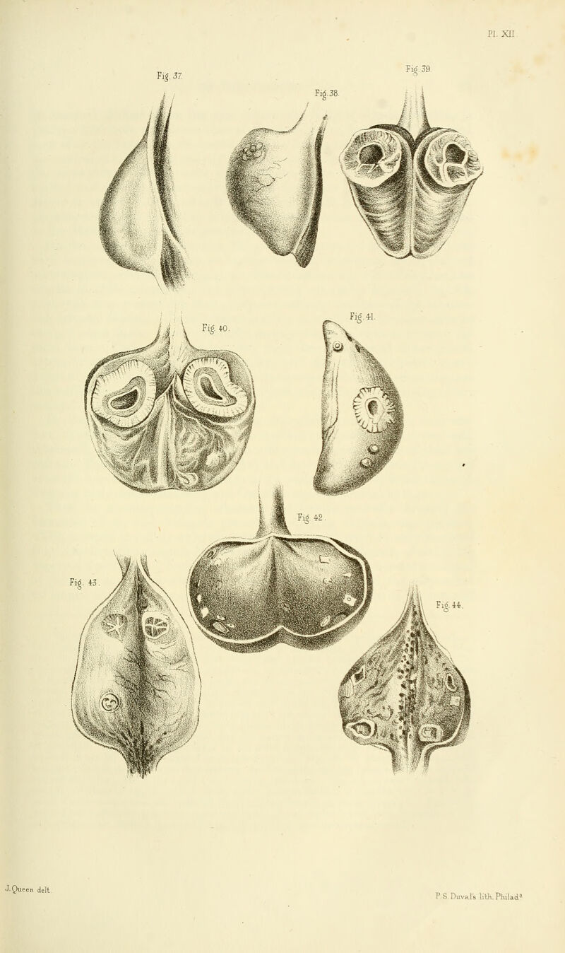 PI. XII Vi$.37. Fitf. 39. Fig. 41. J-Queen delt P.S Duval's litii Phikd?