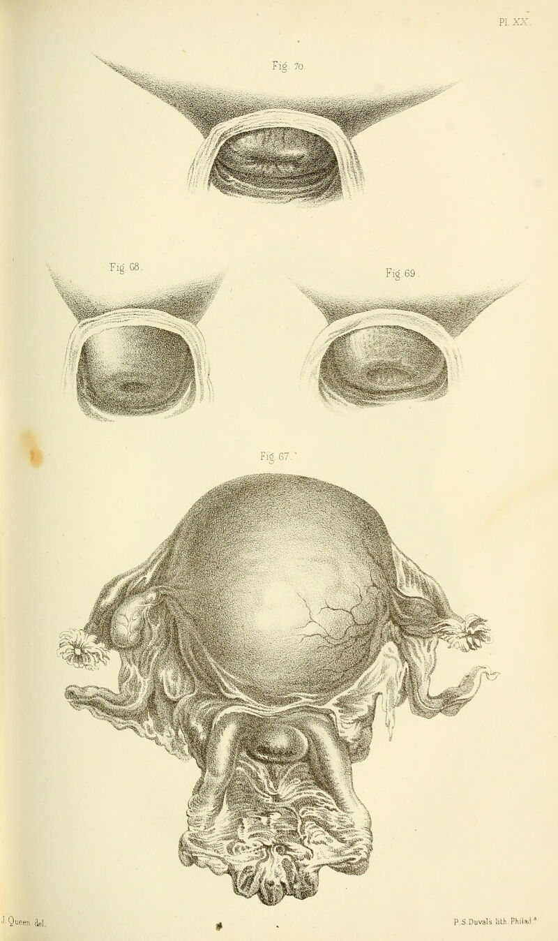 Fig. G8. Fig. 69. ^lllis&s&. Fi£.67.* ■ ?'V ■■'. e? w«m i -: 1;- ;.y P.s.Duvals lith Philwl