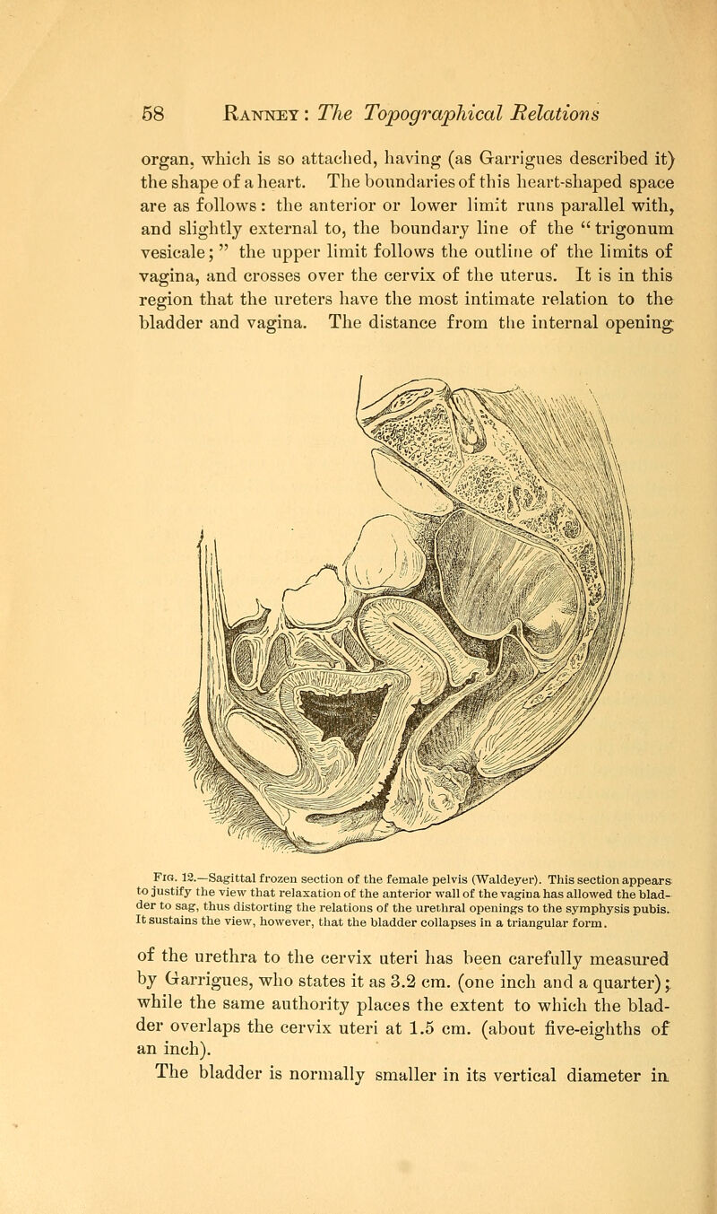 organ, which is so attached, having (as Garrigues described it) the shape of a heart. The boundaries of this heart-shaped space are as follows: the anterior or lower limit runs parallel with, and slightly external to, the boundary line of the  trigonum vesicale;  the upper limit follows the outline of the limits of vagina, and crosses over the cervix of the uterus. It is in this region that the ureters have the most intimate relation to the bladder and vagina. The distance from the internal opening Fig. 12.—Sagittal frozen section of the female pelvis (Waldeyer). This section appears to justify the view that relaxation of the anterior wall of the vagina has allowed the blad- der to sag, thus distorting the relations of the urethral openings to the symphysis pubis. It sustains the view, however, that the bladder collapses in a triangular form. of the urethra to the cervix uteri has been carefully measured by Garrigues, who states it as 3.2 cm. (one inch and a quarter); while the same authority places the extent to which the blad- der overlaps the cervix uteri at 1.5 cm. (about five-eighths of an inch). The bladder is normally smaller in its vertical diameter in.