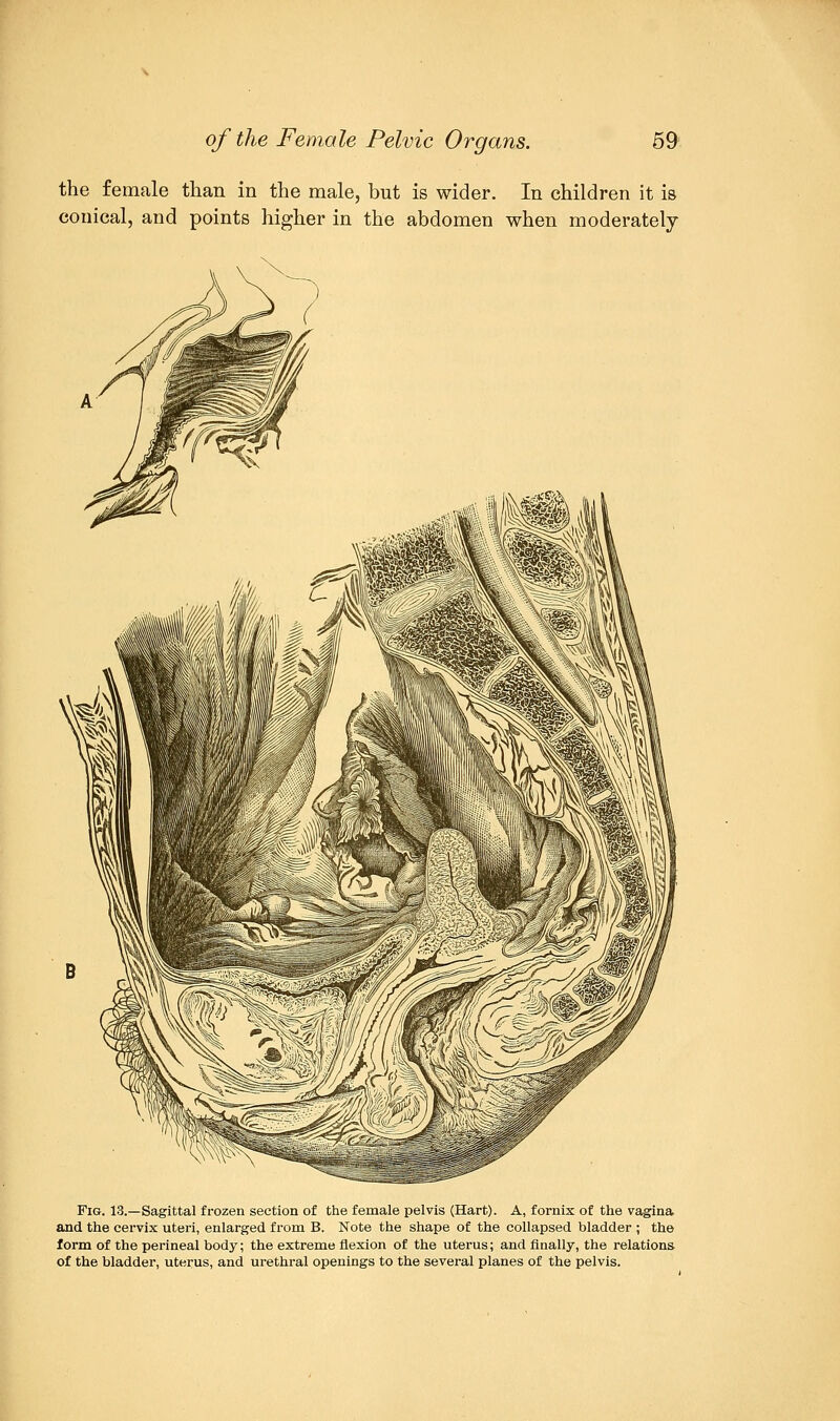 the female than in the male, but is wider. In children it is conical, and points higher in the abdomen when moderately Fig. 13.—Sagittal frozen section of the female pelvis (Hart). A, fornix of the vagina and the cervix uteri, enlarged from B. Note the shape of the collapsed bladder ; the form of the perineal body; the extreme flexion of the uterus; and finally, the relations of the bladder, uterus, and urethral openings to the several planes of the pelvis.