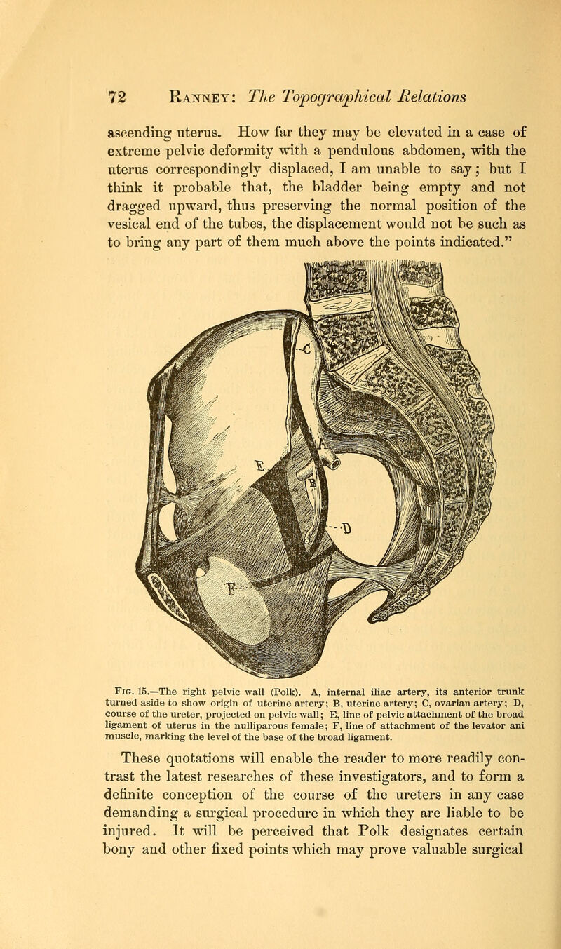 ascending uterus. How far they may be elevated in a case of extreme pelvic deformity with a pendulous abdomen, with the uterus correspondingly displaced, I am unable to say; but I think it probable that, the bladder being empty and not dragged upward, thus preserving the normal position of the vesical end of the tubes, the displacement would not be such as to bring any part of them much above the points indicated. Fig. 15.—The right pelvic wall (Polk). A, internal iliac artery, its anterior trunk turned aside to show origin of uterine artery; B, uterine artery; C, ovarian artery; D, course of the ureter, projected on pelvic wall; E, line of pelvic attachment of the broad ligament of uterus in the nulliparous female; F, line of attachment of the levator ani muscle, marking the level of the base of the broad ligament. These quotations will enable the reader to more readily con- trast the latest researches of these investigators, and to form a definite conception of the course of the ureters in any case demanding a surgical procedure in which they are liable to be injured. It will be perceived that Polk designates certain bony and other fixed points which may prove valuable surgical