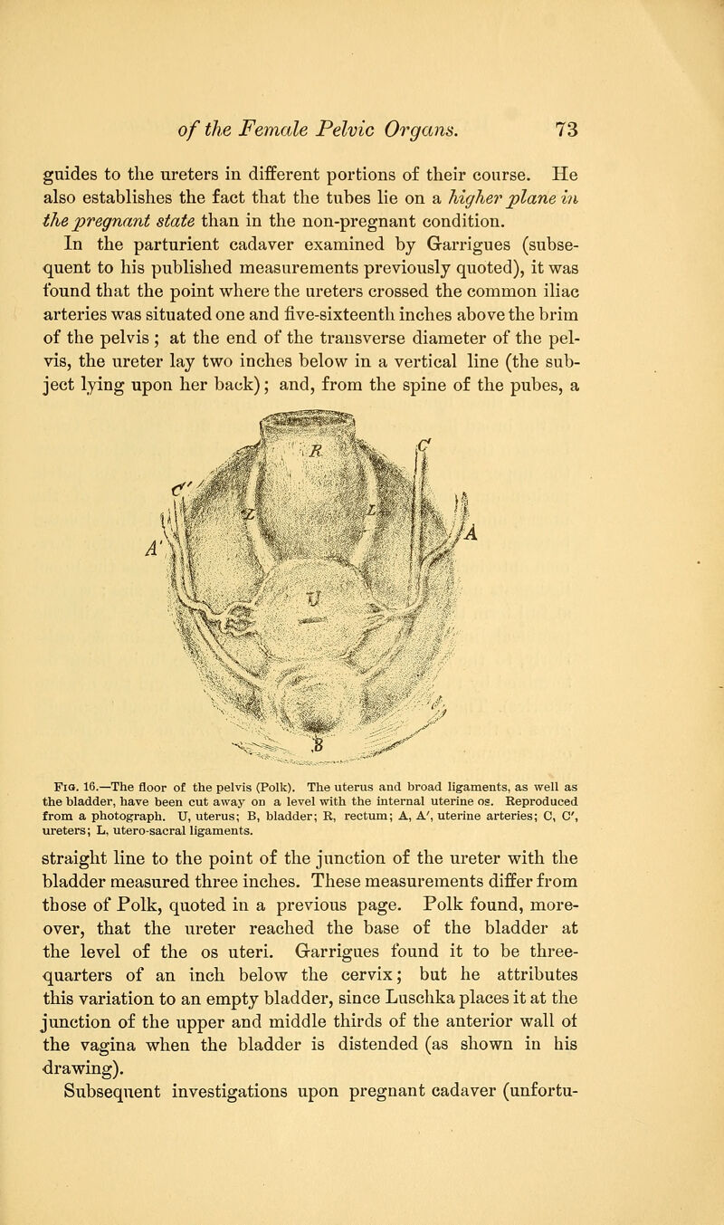 guides to the ureters in different portions of their course. He also establishes the fact that the tubes lie on a higher plane in the pregnant state than in the non-pregnant condition. In the parturient cadaver examined by Garrigues (subse- quent to his published measurements previously quoted), it was found that the point where the ureters crossed the common iliac arteries was situated one and live-sixteenth inches above the brim of the pelvis ; at the end of the transverse diameter of the pel- vis, the ureter lay two inches below in a vertical line (the sub- ject lying upon her back); and, from the spine of the pubes, a M S3 T ^ s Fio. 16.—The floor of the pelvis (Polk). The uterus and broad ligaments, as well as the bladder, have been cut away on a level with the internal uterine os. Reproduced from a photograph. U, uterus; B, bladder; R, rectum; A, A', uterine arteries; C, C, ureters; L, utero-sacral ligaments. straight line to the point of the junction of the ureter with the bladder measured three inches. These measurements differ from those of Folk, quoted in a previous page. Polk found, more- over, that the ureter reached the base of the bladder at the level of the os uteri. Garrigues found it to be three- quarters of an inch below the cervix; but he attributes this variation to an empty bladder, since Luschka places it at the junction of the upper and middle thirds of the anterior wall ot the vagina when the bladder is distended (as shown in his drawing). Subsequent investigations upon pregnant cadaver (unfortu-