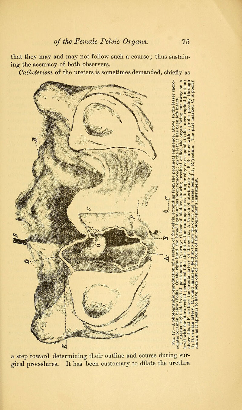 that they may and may not follow such a course; thus sustain- ing the accuracy of both observers. Oatheterism of the ureters is sometimes demanded, chiefly as -2? •Si P 6 ® ! --'53 fc-2 §§^^ <d-p o 0S.a U ^. -^ — P-i §s-.s»* ' • d ° tea ■ „-. > £ m uT) Z, ^ .9 * 0 <u °f a cs o s 2« gsSto| *o .5 to t w 3 © a >• d oj s- «„_, >* ,' PflSPn-.1 ^- K §.2 ?,« *•« .— 05 <*_TP £- c3 £< >_tco S-° > o %~ © 3J°3 p/d JS s-i ^ ® ° 1 2*a*t Si H a.. , JTo d<2 OwBi tu — S a p-s | § a step toward determining their outline and course during sur- gical procedures. It has been customary to dilate the urethra