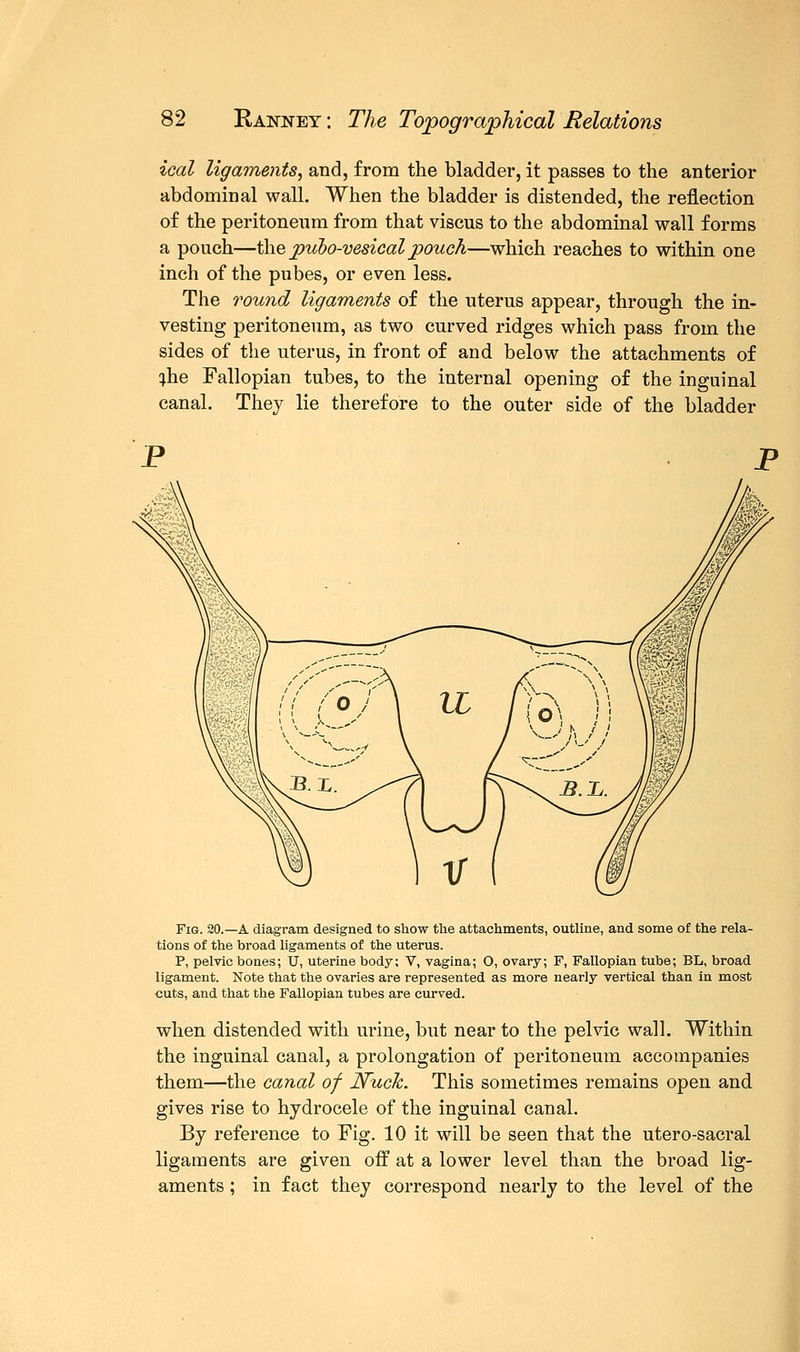 ical ligaments, and, from the bladder, it passes to the anterior abdominal wall. When the bladder is distended, the reflection of the peritoneum from that viscus to the abdominal wall forms a pouch—the pubo-vesicalpouch—which reaches to within one inch of the pubes, or even less. The round ligaments of the uterus appear, through the in- vesting peritoneum, as two curved ridges which pass from the sides of the uterus, in front of and below the attachments of ;he Fallopian tubes, to the internal opening of the inguinal canal. They lie therefore to the outer side of the bladder Fig. 20.—A diagram designed to show the attachments, outline, and some of the rela- tions of the broad ligaments of the uterus. P, pelvic bones; U, uterine body; V, vagina; O, ovary; F, Fallopian tube; BL, broad ligament. Note that the ovaries are represented as more nearly vertical than in most cuts, and that the Fallopian tubes are curved. when distended with urine, but near to the pelvic wall. Within the inguinal canal, a prolongation of peritoneum accompanies them—the canal of Nuch. This sometimes remains open and gives rise to hydrocele of the inguinal canal. By reference to Fig. 10 it will be seen that the utero-sacral ligaments are given off at a lower level than the broad lig- aments ; in fact they correspond nearly to the level of the
