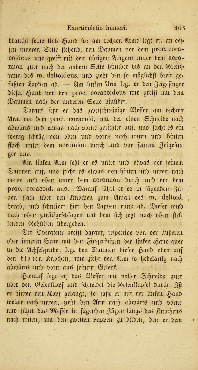 braucht feine linfe <§anb fo: am rechten dritte legt er, an bef- fen inneren ©ette ftefyenb, ben 2)aumen Dor bem proc. cora- coideus unb greift mit ben übrigen gingern unter bem acro- mion quer nacr) ber anbern <5äU r)inü6er U$ an ben ©renj- rattb be3 m. deltoideus, uttb §tet>t bert fo mögltcfjft breit ge- faßten Sappen ah. — 2lm Hufen Slrm legt er bert 3eigefittger biefer «£>anb Dor ben proc. coracoideus itnb greift mit bem Säumen nacr) ber anberen ©eite hinüber. Starauf feist er ba3 peifc^neibige Keffer am rechten Sfrm Dor bem proc. coracoid. mit ber einen (Schreibe ttad) abwärts unb etroaS nact) Dorne gerichtet auf, uub ftid)t e3 ein wenig fct)räg Don oben unb Dorne nacr) unten unb r)inteit flacl) unter bem acromion burct) unb Dor feinem 3^^9efttt^ ger auö. 5lm linfen 5lrm fejjt er e$ unter unb etroaS Dor fernem Daumen auf, unb fticfyt e3 etroa£ Don Wintert itnb unten nacr; Dorne unb oben unter bem acromion burcr; unb Dor bem proc. coracoid. aus. Starauf für)rt er eö in fägenben äu- gen fifacr) über ben ^noc^en §um Slnfafe bc3 m. deltoid. , l)erab, unb fd)neibet bter ben Sappen runb ah. tiefer wirb nacf) oben aurütfgefcfylagen unb bem fiter) je&t nacf) oben fiel- lenben ©efyülfen übergeben. S)er Operateur greift barauf, refpectioe Don ber äußeren ober inneren <5äU mit ben gingerfpi^en ber littfett $anb quer in bie £lcl;fetgrube; legt beu Baumert biefer «ganb oben auf ben bloßen ^noc^eit, unb jtel)t ben 2lrm fo fjebelartig nacr; abwärts uub Dom aus fernem ©elenf. hierauf legt er; ba6 Keffer mit Dotier (Scheibe quer über ben ©elenffopf Uttb fcr)nett>et bie ©elenffapfef buref). 3ft er r)inter bert itopf gefangt, fo faßt er mit ber linfen £anb roeiter nacr) -unten, §iel)t ben 5lrm nacf; abroärt^ unb Dorne nnb fiifjrt baö Keffer in fägenben Sägen fängS beS JtnocjjenS nacf) uutett, um beu jroeitett Sappen ju bifben, ben er t>m