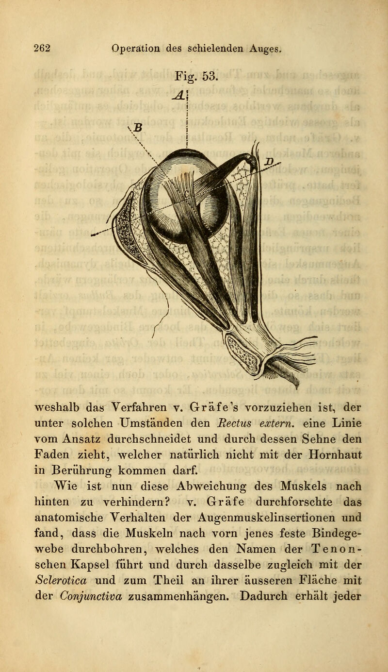 weshalb das Verfahren v. Gräfe's vorzuziehen ist, der unter solchen Umständen den Bectus extern, eine Linie vom Ansatz durchschneidet und durch dessen Sehne den Faden zieht, welcher natürlich nicht mit der Hornhaut in Berührung kommen darf. Wie ist nun diese Abweichung des Muskels nach hinten zu verhindern? v. Gräfe durchforschte das anatomische Verhalten der Augenmuskelinsertionen und fand, dass die Muskeln nach vorn jenes feste Bindege- webe durchbohren, welches den Namen der Tenon- schen Kapsel führt und durch dasselbe zugleich mit der Sclerotica und zum Theii an ihrer äusseren Fläche mit der Conjunctiva zusammenhängen. Dadurch erhält jeder