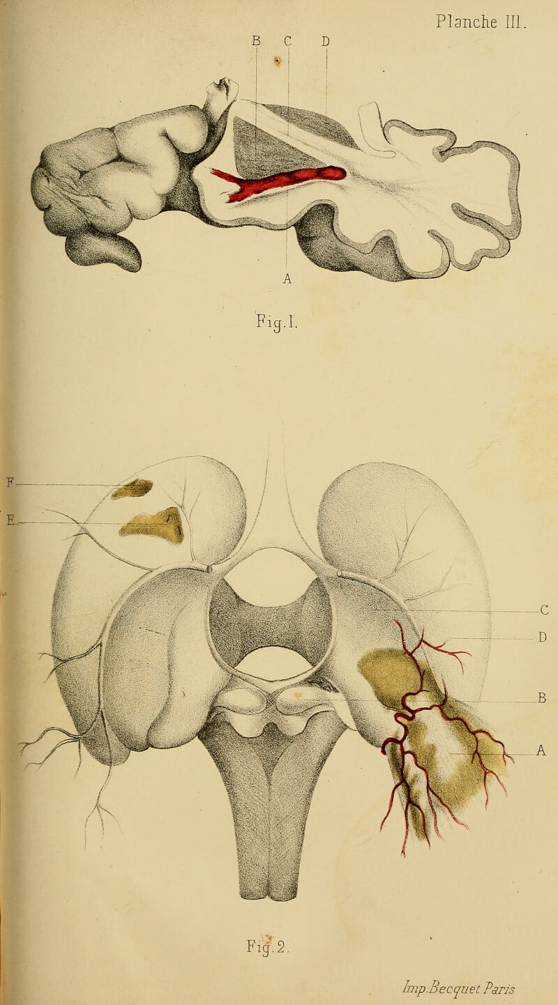 Fig.l. i i V' 1 ' >^^ -r / / Fig^.2. Imp.Becquet Paris