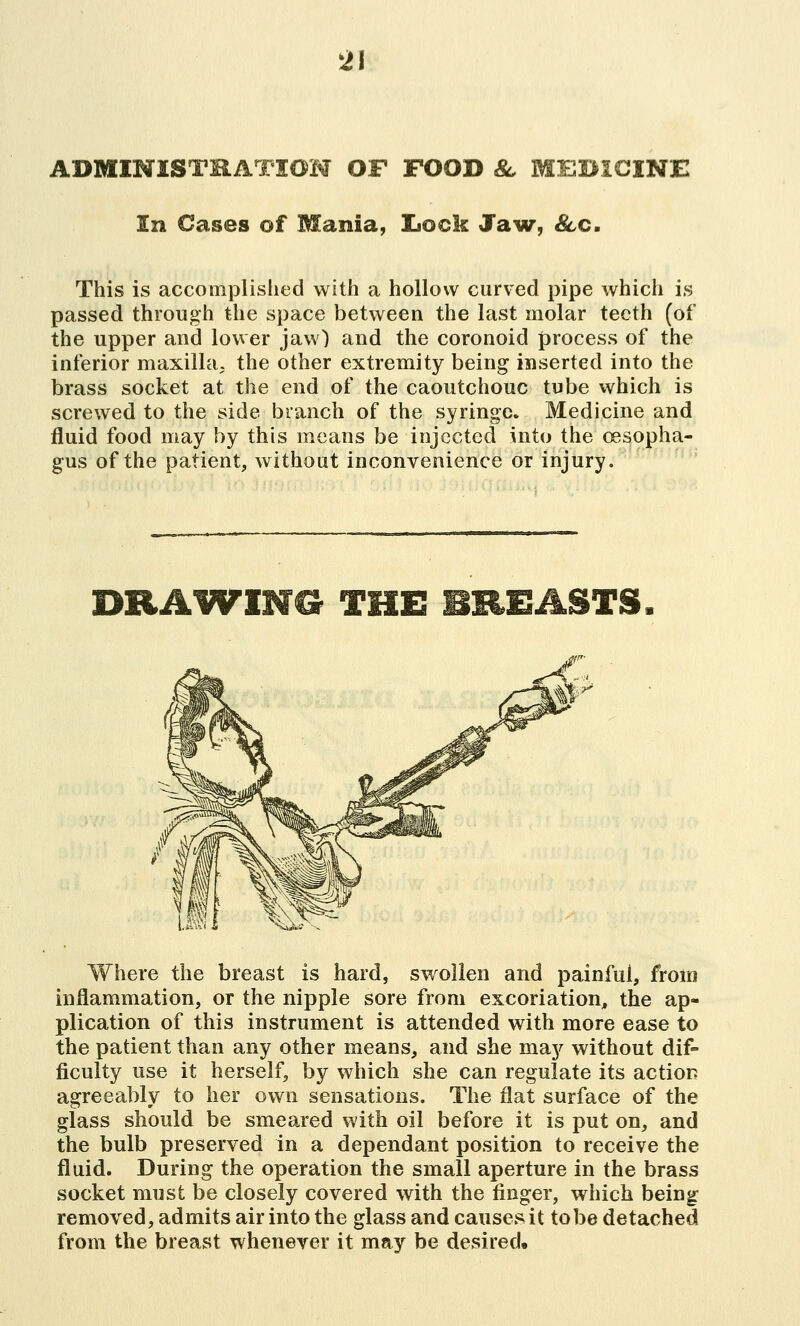 ADMINISTRATION OF FOOD &, MEDICINE In Cases of Mania, Lock Jaw, &c. This is accomplished with a hollow curved pipe which is passed through the space between the last molar teeth (of the upper and lower jaw) and the coronoid process of the inferior maxilla, the other extremity being inserted into the brass socket at the end of the caoutchouc tube which is screwed to the side branch of the syringe Medicine and fluid food may by this means be injected into the oesopha- gus of the patient, without inconvenience or injury. DRAWING THE BREASTS Where the breast is hard, swollen and painful, from inflammation, or the nipple sore from excoriation, the ap- plication of this instrument is attended with more ease to the patient than any other means, and she may without dif- ficulty use it herself, by which she can regulate its action agreeably to her own sensations. The flat surface of the glass should be smeared with oil before it is put on, and the bulb preserved in a dependant position to receive the fluid. During the operation the small aperture in the brass socket must be closely covered with the finger, which being removed, admits air into the glass and causes it tobe detached from the breast whenever it may be desired.
