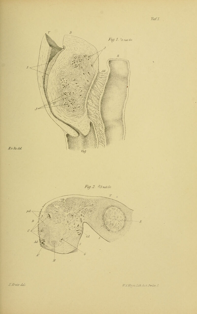 Kv.Re.del, Fu/.l. V2n0ut.Gr. J-*~ Fig. 2. 2/3-nab.Gr. r Jd k^ M *s% \ Is Jf.Äretz deb. rei r _.:,-J: fii ~.J°ri;s: ü
