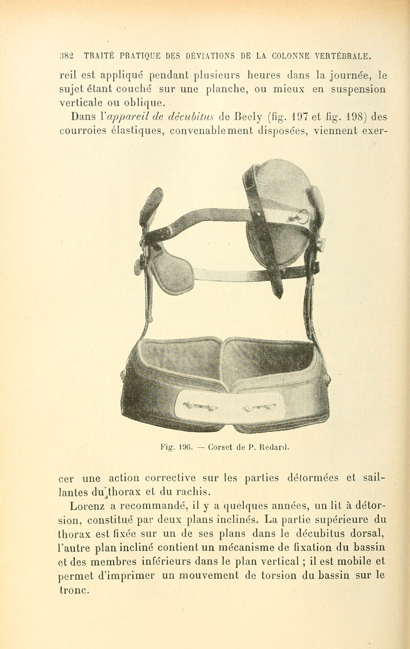 reil est appliqué pendant plusieurs heures dans la journée, le sujet étant couché sur une planche, ou mieux en suspension verticale ou oblique. Dans Vappareil de décubitus de Beely (fig. 197 et fig. 198) des courroies élastiques, convenablement disposées, viennent exer- Fig. 196. — Corset de P. Redard. cer une action corrective sur les parties délormées et sail- lantes dulhorax et du rachis. Lorenz a recommandé, il y a quelques années, un lit à détor- sion, constitué par deux plans inclinés. La partie supérieure du thorax est fixée sur un de ses plans dans le décubitus dorsal, l'autre plan incliné contient un mécanisme de fixation du bassin et des membres inférieurs dans le plan vertical ; il est mobile et permet d'imprimer un mouvement de torsion du bassin sur le tronc.
