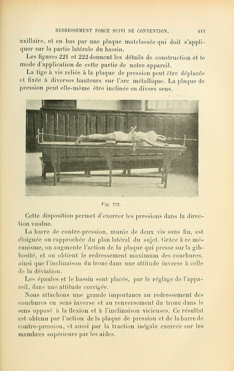 axillaire, et en bas par une plaque matelassée qui doit s'appli- quer sur la partie latérale du bassin. Les figures 221 et 222 donnent les détails de construction et le mode d'application de cette partie de notre appareil. La tige à vis reliée à la plaque de pression peut être déplacée et fixée à diverses hauteurs sur l'arc métallique. La plaque de pression peut elle-même être inclinée en divers sens. Fig. m. Cette disposition permet d'exercer les pressions dans la direc- tion voulue. La barre de contre-pression, munie de deux vis sans fin, est éloignée ou rapprochée du plan latéral du sujet. Grâce à ce mé- canisme, on augmente l'action de la plaque qui presse sur la gib- bosité, et on obtient le redressement maximum des courbures, ainsi que l'inclinaison du tronc dans une attitude inverse à celle de la déviation. Les épaules et le bassin sont placés, par le réglage de l'appa- reil, dans une attitude corrigée. Nous attachons une grande importance au redressement des courbures en sens inverse et au renversement du tronc dans le sens opposé à la flexion et à l'inclinaison vicieuses. Ce résultat est obtenu par l'action delà plaque de pression et de la barre de contre-pression, et aussi par la traction inégale exercée sur les membres supérieurs par les aides.
