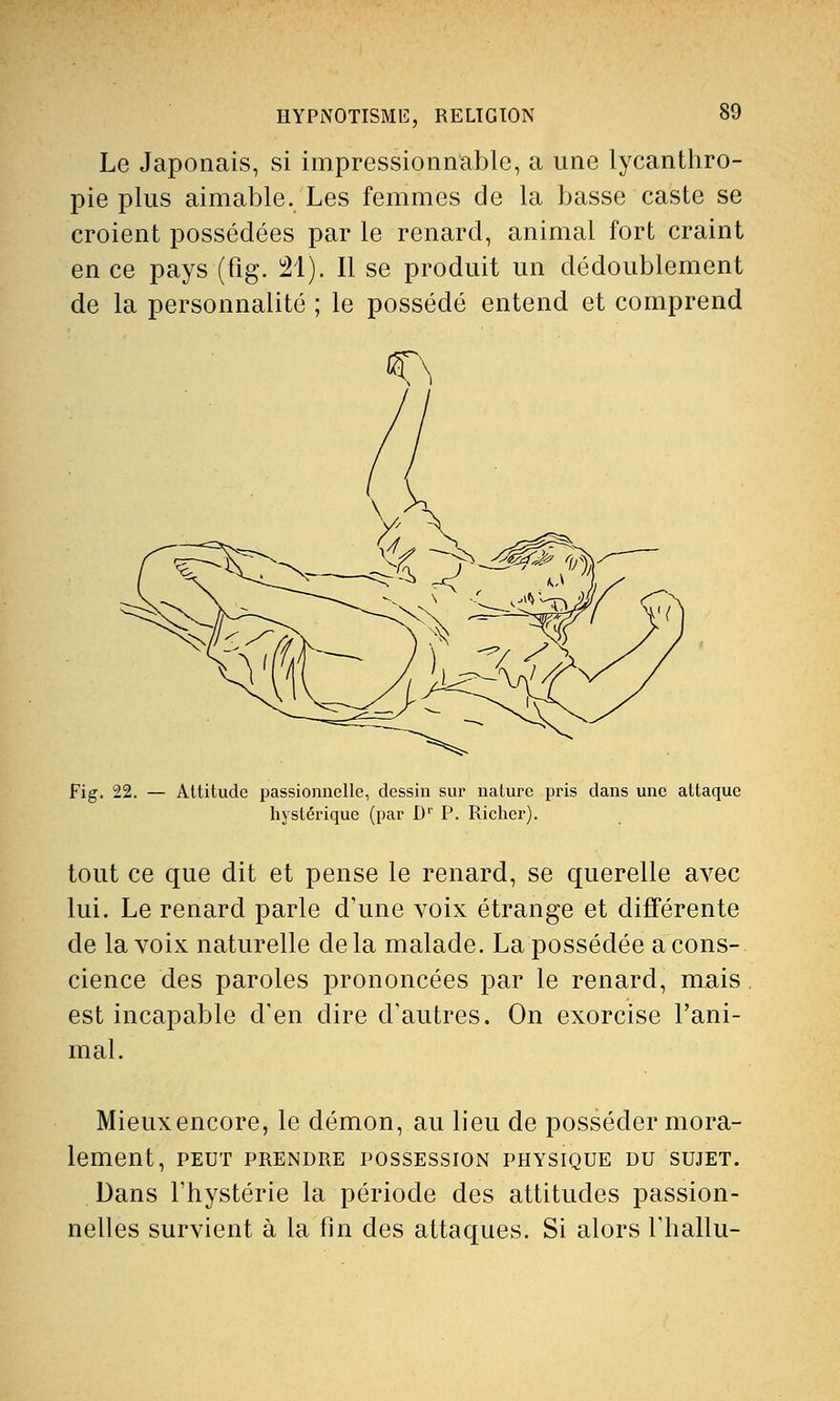 Le Japonais, si impressionnable, a une lycanthro- pie plus aimable. Les femmes de la basse caste se croient possédées par le renard, animal fort craint en ce pays (fig. 21). Il se produit un dédoublement de la personnalité ; le possédé entend et comprend Fig. 22. — Attitude passionnelle, dessin sur nature pris dans une attaque hystérique (par D1' P. Richer). tout ce que dit et pense le renard, se querelle avec lui. Le renard parle d'une voix étrange et différente de la voix naturelle delà malade. La possédée a cons- cience des paroles prononcées par le renard, mais est incapable d'en dire d'autres. On exorcise l'ani- mal. Mieuxencore, le démon, au lieu de posséder mora- lement, PEUT PRENDRE POSSESSION PHYSIQUE DU SUJET. Dans l'hystérie la période des attitudes passion- nelles survient à la fin des attaques. Si alors l'hallu-