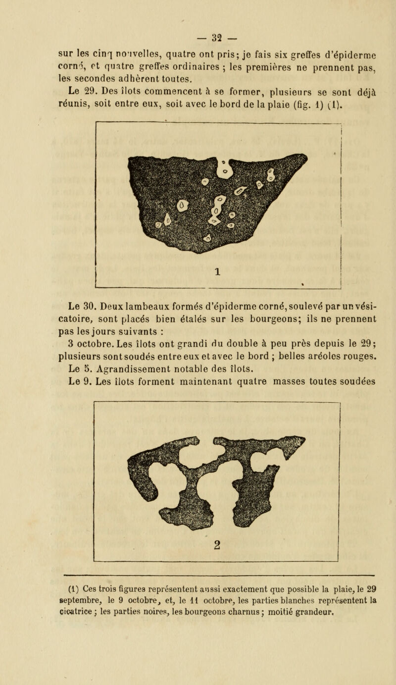 sur les cinq nouvelles, quatre ont pris; je fais six greffes d'épiderme cornô, et quatre greffes ordinaires ; les premières ne prennent pas, les secondes adhèrent toutes. Le 29. Des îlots commencent à se former, plusieurs se sont déjà réunis, soit entre eux, soit avec le bord de la plaie (fig. 1) (1). Le 30. Deux lambeaux formés d'épiderme corné, soulevé par un vési- catoire, sont placés bien étalés sur les bourgeons; ils ne prennent pas les jours suivants : 3 octobre. Les îlots ont grandi du double à peu près depuis le 29; plusieurs sont soudés entre eux et avec le bord ; belles aréoles rouges. Le 5. Agrandissement notable des îlots. Le 9. Les îlots forment maintenant quatre masses toutes soudées (1) Ces trois figures représentent aussi exactement que possible la plaie, le 29 septembre, le 9 octobre, et, le 11 octobre, les parties blanches représentent la cicatrice ; les parties noires, les bourgeons charnus ; moitié grandeur.