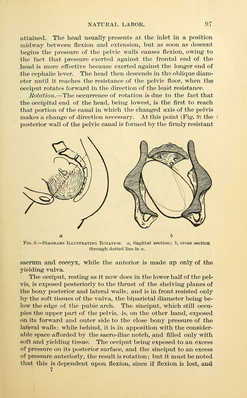 the sinciput and occiput occupy approximately the same plane of the pelvis, both are exposed to an excess of pressure upon the same side, and there is nothing to produce rotation. When these forces have brought about rotation, the occiput sinks into a lower position in the pelvis, and enters the gutter formed by the lower part of the sacrum and the muscles of the pelvic diaphi'agm (Fig. 10); it is then held in its anterior position by the lateral pressure of the ischial-tuberosities, and further ro- tation is therefore impossible; and since the head as a whole lies against the shelving surface of the sacrum, coccyx, and perinseum, the movement of expulsion at once begins. Fig. 10.—Diagram of the Stage of Expulsion, a, Curve of Carus. Expulsion.—The occiput is now free from all but lateral pres- sure, but the frontal end of the head still rests at the bottom of a gutter formed by the shelving posterior wall, and as the child is pressed down from above by the uterine contractions, the sinciput is in its turn driven forward, forcing the occiput be- fore it. The motion of the head during this stage is directly for- ward until the occipital protuberance escapes from under the edge of the symphysis, when the occipital end being entirely freed from pressure, and the neck arrested by the pubic arch, the con- tinued forward motion of the frontal end of the head, which per- sists under the influence of the intra-uterine forces, results in a movement of extension of the head upon the trunk, by which the forehead, face, and chin are successively swept over the fourchette and brought into the world. This movement of ex- tension usually begins at the time that the large fontanelle ap- pears at the edge of the perinseum. Delivery of the Body.—At the time when the head emerges the shoulders are still in the pelvic canal, which they of course enter