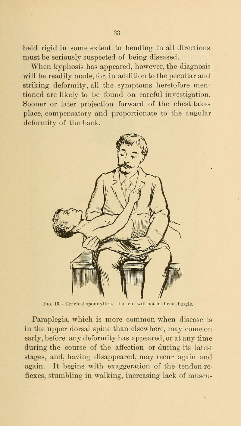 held rigid in some extent to bending in all directions must be seriously suspected of being diseased. When kyphosis has appeared, however, the diagnosis will be readily made, for, in addition to the peculiar and striking deformity, all the symptoms heretofore men- tioned are likely to be found on careful investigation. Sooner or later projection forward of the chest takes place, compensatory and proportionate to the angular deformity of the back. Fig. 16.—Cervical spondylitis. 1 atiuut will not let head dangle. Paraplegia, which is more common when disease is in the upper dorsal spine than elsewhere, may come on early, before any deformity has appeared, or at any time during the course of the affection or during its latest stages, and, having disappeared, may recur again and again. It begins with exaggeration of the tendon-re- flexes, stumbling in walking, increasing lack of muscu-