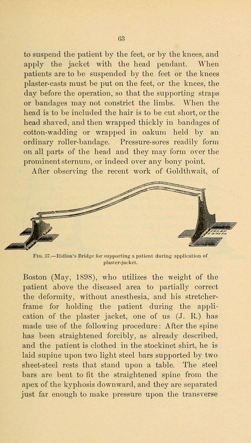 to suspend the patient by the feet, or by the knees, and apply the jacket with the head pendant. When patients are to be suspended by the feet or the knees plaster-casts must be put on the feet, or the knees, the day before the operation, so that the supporting straps or bandages may not constrict the limbs. When the head is to be included the hair is to be cut short, or the head shaved, and then wrapped thickly in bandages of cotton-wadding or wrapped in oakum held by an ordinary roller-bandage. Pressure-sores readily form on all parts of the head and they may form over the prominent sternum, or indeed over any bony point. After observing the recent work of Goldthwait, of Fig. 37.—Ridlon's Bridge for supporting a patient during application of plaster-jacket. Boston (May, 1898), who utilizes the weight of the patient above the diseased area to partially correct the deformity, without anesthesia, and his stretcher- frame for holding the patient during the appli- cation of the plaster jacket, one of us (J. R.) has made use of the following procedure: After the spine has been straightened forcibly, as already described, and the patient is clothed in the stockinet shirt, he is laid supine upon two light steel bars supported by two sheet-steel rests that stand upon a table. The steel bars are bent to fit the straightened spine from the apex of the kyphosis downward, and they are separated just far enough to make pressure upon the transverse
