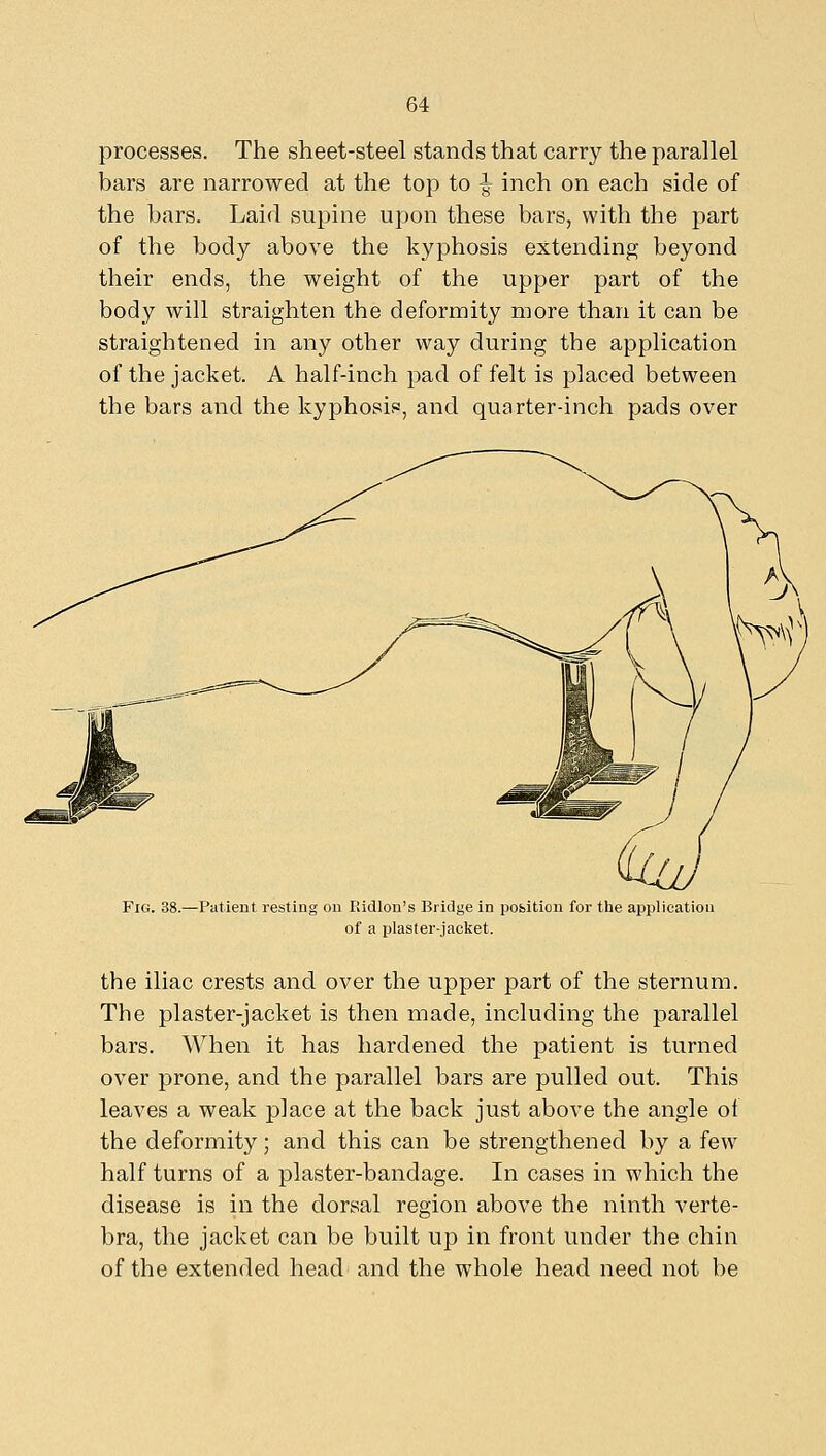 processes. The sheet-steel stands that carry the parallel bars are narrowed at the top to ^ inch on each side of the bars. Laid supine upon these bars, with the part of the body above the kyphosis extending beyond their ends, the weight of the upper part of the body will straighten the deformity more than it can be straightened in any other way during the application of the jacket. A half-inch pad of felt is placed between the bars and the kyphosis, and quarter-inch pads over Fig. 38.- -Patient resting on Ridlon's Bridge in position for the application of a plaster-jacket. the iliac crests and over the upper part of the sternum. The plaster-jacket is then made, including the parallel bars. When it has hardened the patient is turned over prone, and the parallel bars are pulled out. This leaves a weak place at the back just above the angle of the deformity; and this can be strengthened by a few half turns of a plaster-bandage. In cases in which the disease is in the dorsal region above the ninth verte- bra, the jacket can be built up in front under the chin of the extended head and the whole head need not be
