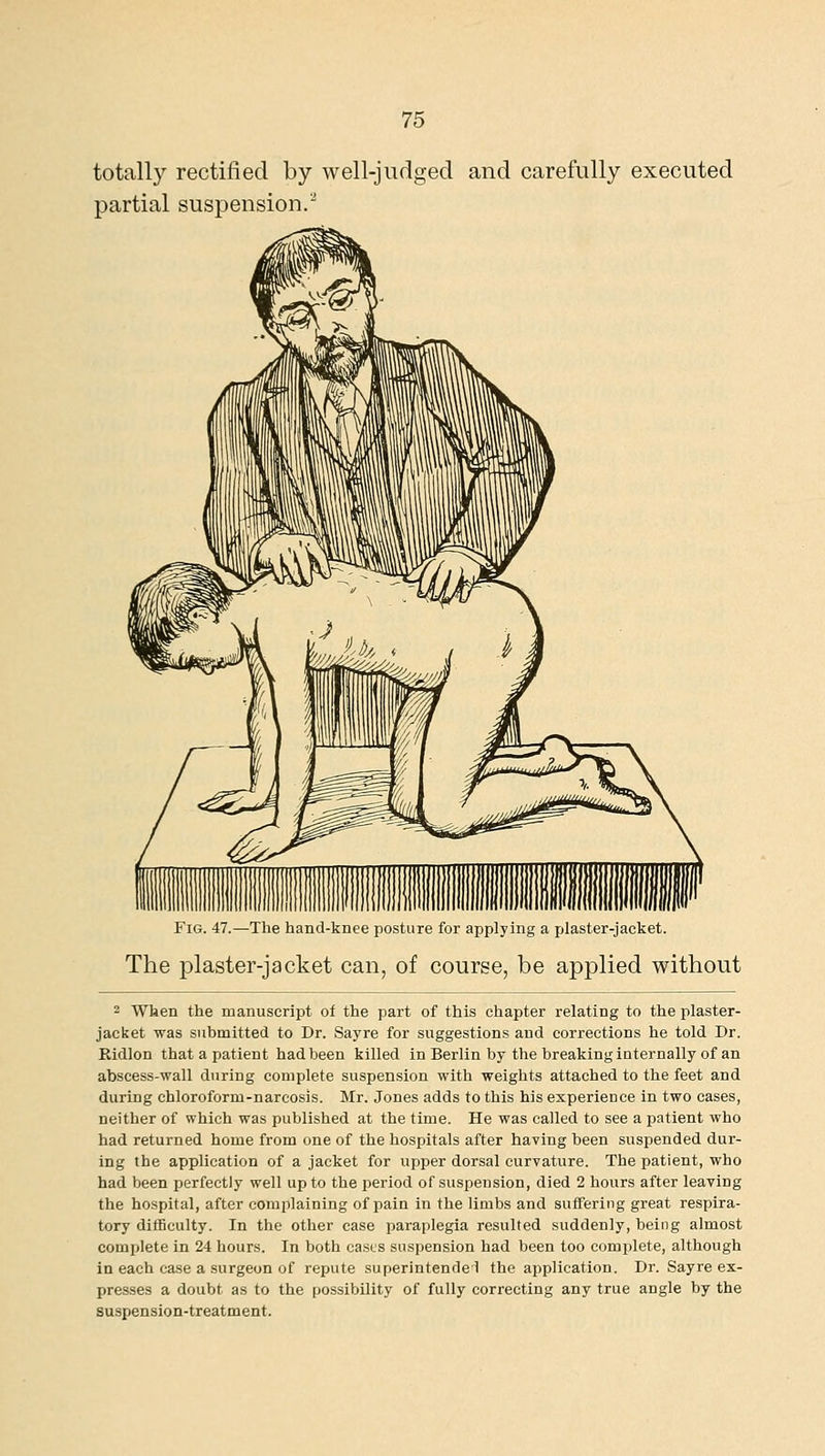 totally rectified by well-judged and carefully executed partial suspension.'* Fig. 47.—The hand-knee posture for applying a plaster-jacket. The plaster-jacket can, of course, be applied without 2 When the manuscript of the part of this chapter relating to the plaster- jacket was submitted to Dr. Sayre for suggestions and corrections he told Dr. Ridlon that a patient had been killed in Berlin by the breaking internally of an abscess-wall during complete suspension with weights attached to the feet and during chloroform-narcosis. Mr. Jones adds to this his experience in two cases, neither of which was published at the time. He was called to see a patient who had returned home from one of the hospitals after having been suspended dur- ing the application of a jacket for upper dorsal curvature. The patient, who had been perfectly well up to the period of suspension, died 2 hours after leaving the hospital, after complaining of pain in the limbs and suffering great respira- tory difficulty. In the other case paraplegia resulted suddenly, being almost complete in 24 hours. In both casts suspension had been too complete, although in each case a surgeon of repute superintended the application. Dr. Sayre ex- presses a doubt as to the possibility of fully correcting any true angle by the suspension-treatment.