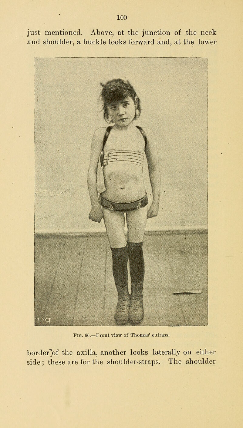 just mentioned. Above, at the junction of the neck and shoulder, a buckle looks forward and, at the lower Fig. 66.—Front view of Thomas' cuirass. border'of the axilla, another looks laterally on either side ; these are for the shoulder-straps. The shoulder