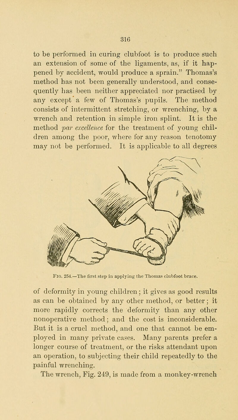 to be performed in curing clubfoot is to produce such an extension of some of the ligaments, as, if it hap- pened by accident, would produce a sprain. Thomas's method has not been generally understood, and conse- quently has been neither appreciated nor practised by any except a few of Thomas's pupils. The method consists of intermittent stretching, or wrenching, by a wrench and retention in simple iron splint. It is the method ipar excellence for the treatment of young chil- dren among the poor, where for any reason tenotomy may not be performed. It is applicable to all degrees Fig. 254.—The first step in applying the Thomas clubfoot brace. of deformity in young children; it gives as good results as can be obtained by any other method, or better; it more rapidly corrects the deformity than any other nonoperative method; and the cost is inconsiderable. But it is a cruel method, and one that cannot be em- ployed in many private cases. Many parents prefer a longer course of treatment, or the risks attendant upon an operation, to subjecting their child repeatedly to the painful wrenching. The wrench, Fig. 249, is made from a monkey-wrench