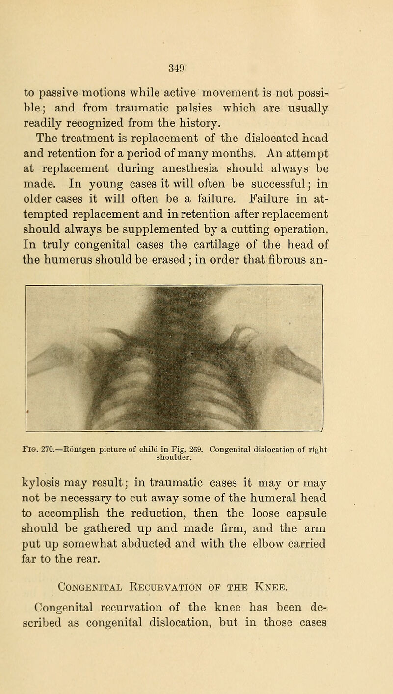 to passive motions while active movement is not possi- ble; and from traumatic palsies which are usually readily recognized from the history. The treatment is replacement of the dislocated head and retention for a period of many months. An attempt at replacement during anesthesia should always be made. In young cases it will often be successful; in older cases it will often be a failure. Failure in at- tempted replacement and in retention after replacement should always be supplemented by a cutting operation. In truly congenital cases the cartilage of the head of the humerus should be erased; in order that fibrous an- FiG. 270.—Eontgen picture of child in Fig. 269. Congenital dislocation of right shoulder. kylosis may result; in traumatic cases it may or may not be necessary to cut away some of the humeral head to accomplish the reduction, then the loose capsule should be gathered up and made firm, and the arm put up somewhat abducted and with the elbow carried far to the rear. Congenital Recurvation or the Knee. Congenital recurvation of the knee has been de- scribed as congenital dislocation, but in those cases