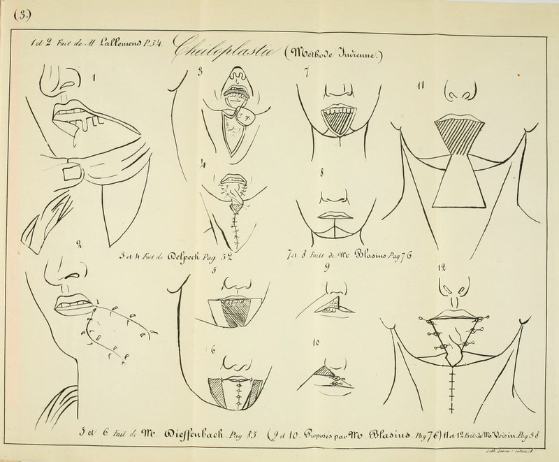 (5) /d 2 Fa^y ^ ^^/ Va.(ùiXXCiul P.J>1. ,1 ^H h/à,i/e Gic^^fA Pa^ ^'i /^ à d 6 Ai/ ,/, ^TC COie/fcut'acPi .A^ /j (j^e(^ /^. ^'^^.i poc.^e». ^fa^iii^. /â^/^) fht \'il!,iOJM>Vy.iixxP,ç.âS ZxlJt £0^^*ù-r ùfiC^Ui. J'