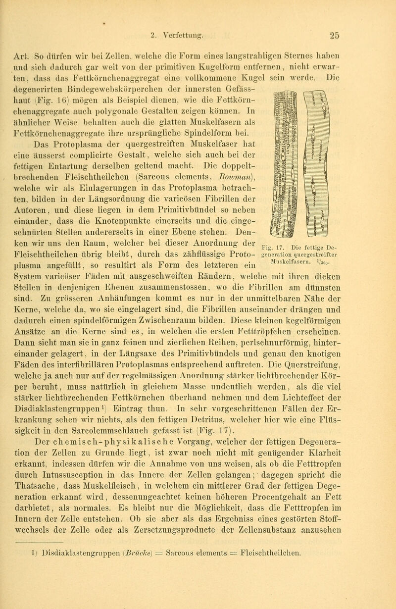 Fig. 17. Die fettige De- generation quergestreifter Muskelfasern. Väoo- Art. So dürfen wir bei Zellen, welche die Form eines langstrahligen Sternes haben und sich dadurch gar weit von der primitiven Kugelform entfernen, nicht erwar- ten, dass das Fettkörnchenaggregat eine vollkommene Kugel sein werde. Die degenerirten Bindegewebskörperchen der innersten Gefäss- haut (Fig. 16) mögen als Beispiel dienen, wie die Fettkörn- chenaggregate auch polygonale Gestalten zeigen können. In ähnlicher Weise behalten auch die glatten Muskelfasern als Fettkörnchenaggregate ihre ursprüngliche Spindelform bei. Das Protoplasma der quergestreiften Muskelfaser hat eine äusserst complicirte Gestalt, welche sich auch bei der fettigen Entartung derselben geltend macht. Die doppelt- brechenden Fleischtheilchen (Sarcous elements, Botvman), welche wir als Einlagerungen in das Protoplasma betrach- ten, bilden in der Längsordnung die varicösen Fibrillen der Autoren, und diese liegen in dem Primitivbündel so neben einander, dass die Knotenpunkte einerseits und die einge- schnürten Stellen andererseits in einer Ebene stehen. Den- ken wir uns den Raum, welcher bei dieser Anordnung der Fleischtheilchen übrig bleibt, durch das zähflüssige Proto- plasma angefüllt, so resultirt als Form des letzteren ein System varicöser Fäden mit ausgeschweiften Rändern, welche mit ihren dicken Stellen in denjenigen Ebenen zusammenstossen, wo die Fibrillen am dünnsten sind. Zu grösseren Anhäufungen kommt es nur in der unmittelbaren Nähe der Kerne, welche da, wo sie eingelagert sind, die Fibrillen auseinander drängen und dadurch einen spindelförmigen Zwischenraum bilden. Diese kleinen kegelförmigen Ansätze an die Kerne sind es, in welchen die ersten Fetttröpfchen erscheinen. Dann sieht man sie in ganz feinen und zierlichen Reihen, perlschnurförmig, hinter- einander gelagert, in der Längsaxe des Primitivbündels und genau den knotigen Fäden des interfibrillären Protoplasmas entsprechend auftreten. Die Querstreifung, welche ja auch nur auf der regelmässigen Anordnung stärker lichtbrechender Kör- per beruht, muss natürlich in gleichem Masse undeutlich werden, als die viel stärker lichtbrechenden Fettkörnchen überhand nehmen und dem Lichteffect der Disdiaklastengruppen1) Eintrag thun. In sehr vorgeschrittenen Fällen der Er- krankung sehen wir nichts, als den fettigen Detritus, welcher hier wie eine Flüs- sigkeit in den Sarcolemmschlauch gefasst ist (Fig. 1.7). Der chemisch-physikalische Vorgang, welcher der fettigen Degenera- tion der Zellen zu Grunde liegt, ist zwar noch nicht mit genügender Klarheit erkannt, indessen dürfen wir die Annahme von uns weisen, als ob die Fetttropfen durch Intussusception in das Innere der Zellen gelangen; dagegen spricht die Thatsache, dass Muskelfleisch, in welchem ein mittlerer Grad der fettigen Dege- neration erkannt wird, dessenungeachtet keinen höheren Procentgehalt an Fett darbietet, als normales. Es bleibt nur die Möglichkeit, dass die Fetttropfen im Innern der Zelle entstehen. Ob sie aber als das Ergebniss eines gestörten Stoff- wechsels der Zelle oder als Zersetzungsproducte der Zellensubstanz anzusehen 1) Disdiaklastengruppen (Brücke) = Sarcous elements = Fleischtheilchen.