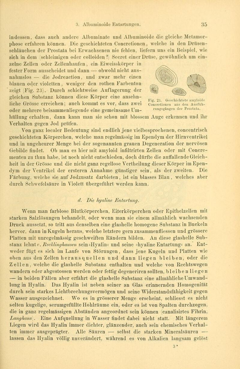 indessen, dass auch andere Albuminate und Albuminoide die gleiche Metamor- phose erfahren können. Die geschichteten Concretionen, welche in den Drüsen- schläuchen der Prostata bei Erwachsenen nie fehlen, liefern uns ein Beispiel, wie sich in dem (schleimigen oder colloiden?) Secret einer Drüse, gewöhnlich um ein- zelne Zellen oder Zellenhaufen, ein Eiweisskörper in fester Form ausscheidet und dann — obwohl nicht aus- nahmslos — die Jodreaction, und zwar mehr einen blauen oder violetten, weniger den rothen Farbenton zeigt (Fig. 23). Durch schichtweise Auflagerung der gleichen Substanz können diese Körper eine ansehn- liche Grösse erreichen; auch kommt es vor, dass zwei oder mehrere beisammenliegende eine gemeinsame Um- hüllung erhalten, dann kann man sie schon mit blossem Auge erkennen und ihr Verhalten gegen Jod prüfen. Von ganz localer Bedeutung sind endlich jene vielbesprochenen, concentrisch geschichteten Körperchen, welche man regelmässig im Ependym der Hirnventrikel und in ungeheurer Menge bei der sogenannten grauen Degeneration der nervösen Gebilde findet. Ob man es hier mit amyloid infütrirten Zellen oder mit Concre- menten zu thun habe, ist noch nicht entschieden, doch dürfte die auffallende Gleich- heit in der Grösse und die nicht ganz regellose Vertheilung dieser Körper im Epen- dym der Ventrikel der ersteren Annahme günstiger sein, als der zweiten. Die Färbung, welche sie auf Jodzusatz darbieten, ist ein blasses Blau, welches aber durch Schwefelsäure in Violett übergeführt werden kann. Fig. 2:3. Geschichtete amyloide Concretionen aus den Ausfüh- rungsgängen der Prostata. cl. Die hyaline Entartung. Wenn man farblose Blutkörperchen, Eiterkörperchen oder Epithelzellen mit starken Salzlösungen behandelt, oder wenn man sie einem allmählich wachsenden Druck aussetzt, so tritt aus denselben eine glashelle homogene Substanz in Buckeln hervor, dann in Kugeln heraus, welche letztere gern zusammenfüessen und grössere Platten mit unregelmässig geschweiften Rändern bilden. An diese glashelle Sub- stanz lehnt v. Recklinghausen sein »Hyalin« und seine »hyaline Entartung« an. Ent- weder fügt es sich im Laufe von Störungen, dass jene Kugeln und Platten wie oben aus den Zellen herausquellen und dann liegen bleiben, oder die Zellen, welche die glashelle Substanz enthalten und welche von Rechtswegen wandern oder abgestossen werden oder fettig degenerirensollten, bleiben liegen — in beiden Fällen aber erfährt die glashelle Substanz eine allmähliche Umwand- lung in Hyalin. Das Hyalin ist neben seiner an Glas erinnernden Homogenität durch sein starkes Lichtbrechungsvermögen und seine Widerstandsfähigkeit gegen Wasser ausgezeichnet. Wo es in grösserer Menge erscheint, schliesst es nicht selten kugelige, serumgefüllte Hohlräume ein, oder es ist von Spalten durchzogen, die in ganz regelmässigen Abständen angeordnet sein können (canalisirtes Fibrin, Langhans). Eine Aufquellung in Wasser findet dabei nicht statt. Mit längerem Liegen wird das Hyalin immer dichter, glänzender, auch sein chemisches Verhal- ten immer ausgeprägter. Alle Säuren — selbst die starken Mineralsäuren — lassen das Hyalin völlig unverändert, während es von Alkalien langsam gelöst 3*