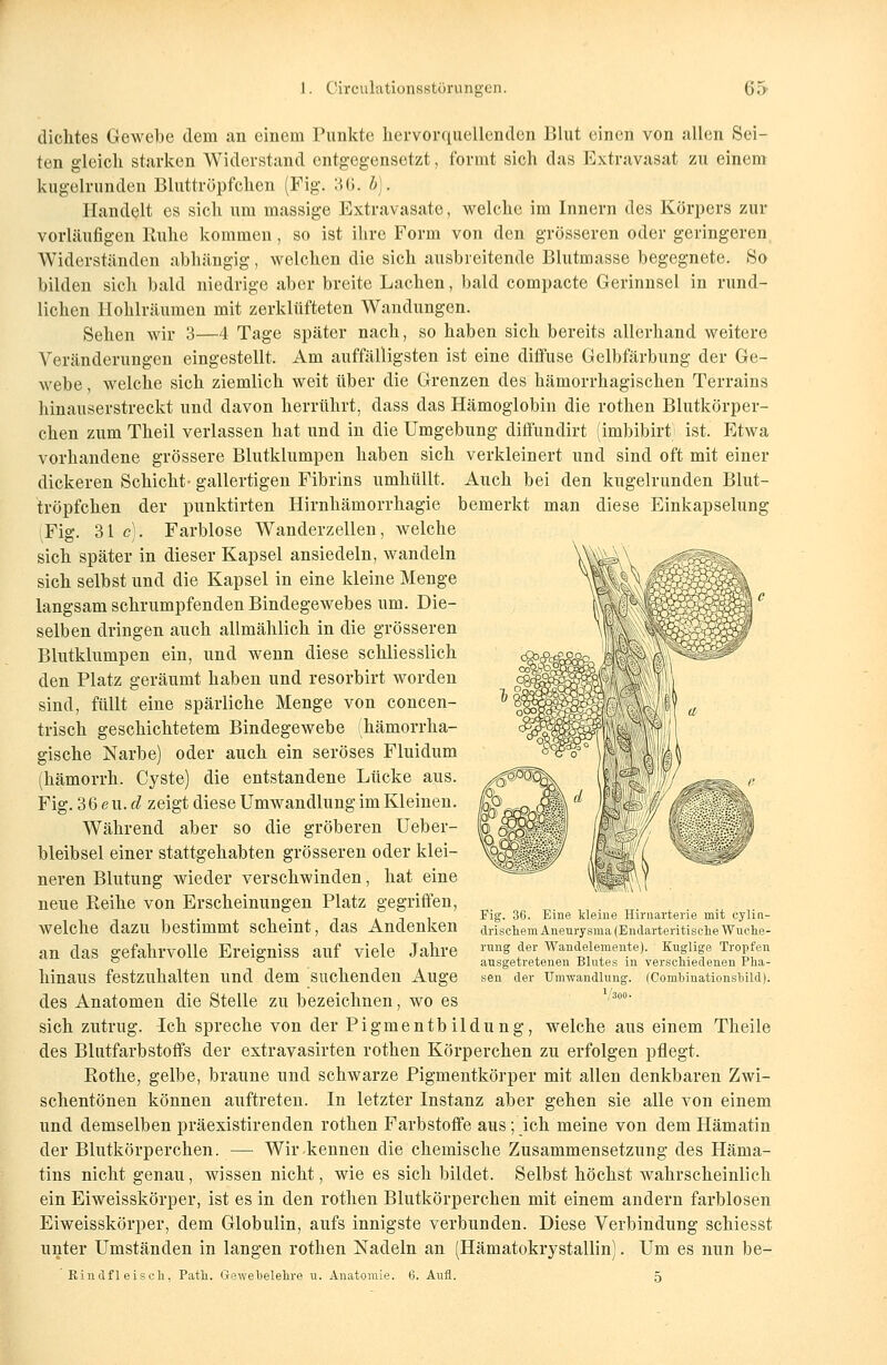 dichtes Gewebe (lern an einem Punkte hervorquellenden Blut einen von allen Sei- ten gleich starken Widerstand entgegensetzt, formt sich das Extravasat zu einem kugelrunden Bluttröpfchen (Fig. 36. V). Handelt es sich um massige Extravasate, welche im Innern des Körpers zur vorläufigen Ruhe kommen, so ist ihre Form von den grösseren oder geringeren Widerständen abhängig, welchen die sich ausbreitende Blutmasse begegnete. So bilden sich bald niedrige aber breite Lachen, bald compacte Gerinnsel in rund- lichen Hohlräumen mit zerklüfteten Wandungen. Sehen wir 3—4 Tage später nach, so haben sich bereits allerhand weitere Veränderungen eingestellt. Am auffälligsten ist eine diffuse Gelbfärbung der Ge- webe , welche sich ziemlich weit über die Grenzen des hämorrhagischen Terrains hinauserstreckt und davon herrührt, dass das Hämoglobin die rothen Blutkörper- chen zum Theil verlassen hat und in die Umgebung diffundirt (imbibirt; ist. Etwa vorhandene grössere Blutklumpen haben sich verkleinert und sind oft mit einer dickeren Schicht* gallertigen Fibrins umhüllt. Auch bei den kugelrunden Blut- tröpfchen der punktirten Hirnhämorrhagie bemerkt man diese Einkapselung iFig. 31c). Farblose Wanderzellen, welche sich später in dieser Kapsel ansiedeln, wandeln sich selbst und die Kapsel in eine kleine Menge langsam schrumpfenden Bindegewebes um. Die- selben dringen auch allmählich in die grösseren Blutklumpen ein, und wenn diese schliesslich den Platz geräumt haben und resorbirt worden sind, füllt eine spärliche Menge von concen- trisch geschichtetem Bindegewebe (hämorrha- gische Narbe) oder auch ein seröses Fluidum (hämorrh. Cyste) die entstandene Lücke aus. Fig. 3 6 e u. cl zeigt diese Umwandlung im Kleinen. Während aber so die gröberen Ueber- bleibsel einer stattgehabten grösseren oder klei- neren Blutung wieder verschwinden, hat eine neue Reihe von Erscheinungen Platz gegriffen, welche dazu bestimmt scheint, das Andenken an das gefahrvolle Ereigniss auf viele Jahre hinaus festzuhalten und dem suchenden Auge des Anatomen die Stelle zu bezeichnen, wo es sich zutrug. Ich spreche von der Pigmentbildung, welche aus einem Theile des Blutfarbstoffs der extravasalen rothen Körperchen zu erfolgen pflegt. Rothe, gelbe, braune und schwarze Pigmentkörper mit allen denkbaren Zwi- schentönen können auftreten. In letzter Instanz aber gehen sie alle von einem und demselben präexistirenden rothen Farbstoffe aus; ich meine von dem Hämatin der Blutkörperchen. — Wir kennen die chemische Zusammensetzung des Häma- tins nicht genau, wissen nicht, wie es sich bildet. Selbst höchst wahrscheinlich ein Eiweisskörper, ist es in den rothen Blutkörperchen mit einem andern farblosen Eiweisskörper, dem Globulin, aufs innigste verbunden. Diese Verbindung schiesst unter Umständen in langen rothen Nadeln an (Hämatokrystallin). Um es nun be- Rindfl eisch, Patli. Gewebelehre u. Anatomie. 6. Aufl. 5 Fig. 36. Eine kleine Hirnarterie mit cylin- drischem Aneurysma (Endarteritische Wuche- rung der Wandelemente). Kuglige Tropfen ausgetretenen Blutes in verschiedenen Pha- sen der Umwandlung. (Combinationshild).