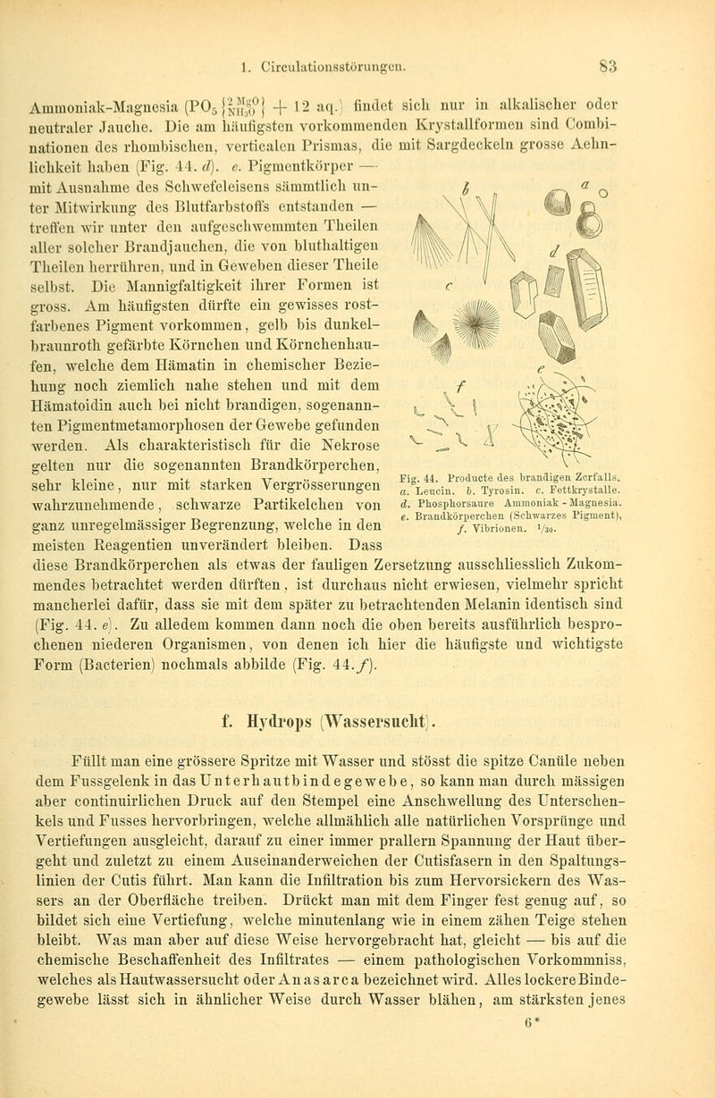 Ammoniak-Magnesia (P.OsjSSPJ + 12 a<l0 nndet sicl1 nur in alkaliscüer oder neutraler Jauche. Die am häufigsten vorkommenden Krystallformen sind Combi- nationen des rhombischen, verticalen Prismas, die mit Sargdeckeln grosse Aehn- lichkeit haben (Fig. 44. d). e. Pigmentkörper — mit Ausnahme des Schwefeleisens sämmtlich un- ter Mitwirkung des Blutfarbstoffs entstanden — treffen wir unter den aufgeschwemmten Theilen aller solcher Brandjauchen, die von bluthaltigen Theilen herrühren, und in Geweben dieser Theile selbst. Die Mannigfaltigkeit ihrer Formen ist gross. Am häufigsten dürfte ein gewisses rost- farbenes Pigment vorkommen, gelb bis dunkel- braunroth gefärbte Körnchen und Körnchenhau- fen, welche dem Hämatin in chemischer Bezie- hung noch ziemlich nahe stehen und mit dem Hämatoidin auch bei nicht brandigen, sogenann- ten Pigmentmetamorphosen der Gewebe gefunden werden. Als charakteristisch für die Nekrose gelten nur die sogenannten Brandkörpereken, sehr kleine, nur mit starken Vergrösserungen wahrzunehmende, schwarze Partikelchen von ganz unregelmässiger Begrenzung, welche in den meisten Reagentien unverändert bleiben. Dass diese Brandkörpereken als etwas der fauligen Zersetzung ausschliesslich Zukom- mendes betrachtet werden dürften, ist durchaus nicht erwiesen, vielmehr spricht mancherlei dafür, dass sie mit dem später zu betrachtenden Melanin identisch sind (Fig. 44. e). Zu alledem kommen dann noch die oben bereits ausführlich bespro- chenen niederen Organismen, von denen ich hier die häufigste und wichtigste Form (Bacterien) nochmals abbilde (Fig. 44./). Fig. 44. Producte des brandigen Zerfalls. a. Leucin. 6. Tyrosin. c. Fettkrystalle. d. Phosphorsaure Ammoniak - Magnesia. e. Brandkörperchen (Schwarzes Pigment), /. Vibrionen. 1/30. f. Hydrops (Wassersucht). Füllt man eine grössere Spritze mit Wasser und stösst die spitze Canüle neben dem Fussgelenk in das Unterh autbin de ge webe, so kann man durch massigen aber continuirlichen Druck auf den Stempel eine Anschwellung des Unterschen- kels und Fusses hervorbringen, welche allmählich alle natürlichen Vorsprünge und Vertiefungen ausgleicht, darauf zu einer immer prallern Spannung der Haut über- geht und zuletzt zu einem Auseinanderweichen der Cutisfasern in den Spaltungs- linien der Cutis führt. Man kann die Infiltration bis zum Hervorsickern des Was- sers an der Oberfläche treiben. Drückt man mit dem Finger fest genug auf, so bildet sich eine Vertiefung, welche minutenlang wie in einem zähen Teige stehen bleibt. Was man aber auf diese Weise hervorgebracht hat, gleicht — bis auf die chemische Beschaffenheit des Infiltrates — einem pathologischen Vorkommniss, welches als Hautwassersucht oder Anas arca bezeichnet wird. Alles lockere Binde- gewebe lässt sich in ähnlicher Weise durch Wasser blähen, am stärksten jenes