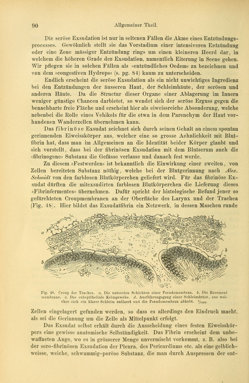 Die seröse Exsudation ist nur in seltenen Fällen die Akme eines Entzündungs- processes. Gewöhnlich stellt sie das Vorstadium einer intensiveren Entzündung oder eine Zone massiger Entzündung rings um einen kleineren Heerd dar, in welchem die höheren Grade den Exsudation, namentlich Eiterung in Scene gehen. Wir pflegen sie in solchen Fällen als »entzündliches Oedem« zu bezeichnen und von dem »congestiven Hydrops« (s. pg. 84) kaum zu unterscheiden. Endlich erscheint die seröse Exsudation als ein nicht unwichtiges Ingredienz bei den Entzündungen der äusseren Haut, der Schleimhäute, der serösen und anderen Häute. Da die Structur dieser Organe einer Ablagerung im Innern weniger günstige Chancen darbietet, so wendet sich der seröse Erguss gegen die benachbarte freie Fläche und erscheint hier als eiweissreiche Absonderung, welche nebenbei die Eolle eines Vehikels für die etwa in dem Parenchym der Haut vor- handenen Wanderzellen übernehmen kann. Das fibrinöse Exsudat zeichnet sich durch seinen Gehalt an einem spontan gerinnenden Eiweisskörper aus, welcher eine so grosse Aehnlichkeit mit Blut- fibrin hat, dass man im Allgemeinen an die Identität beider Körper glaubt und sich vorstellt, dass bei der fibrinösen Exsudation mit dem Blutserum auch die »fibrinogene« Substanz die Gefässe verlasse und danach fest werde. Zu diesem »Festwerden« ist bekanntlich die Einwirkung einer zweiten, von Zellen bereiteten Substanz nöthig, welche bei der Blutgerinnung nach Alex. Schmidt von den farblosen Blutkörperchen geliefert wird. Für das fibrinöse Ex- sudat dürften die mitexsudirten farblosen Blutkörperchen die Lieferung dieses »Fibrinfermentes« übernehmen. Dafür spricht der histologische Befund jener so gefürchteten Croupmembranen an der Oberfläche des Larynx und der Trachea (Fig. 48). Hier bildet das Exsudatfibrin ein Netzwerk, in dessen Maschen runde Fig. 48. Croup der Trachea, a. Die untersten Schichten einer Pseudomembran, b. Die Basement memhrane. c. Das subepitheliale Eeimgewebe. d. Ausführungsgang einer Schleimdrüse, aus wel- cher sich ein klarer Schleim entleert und die Pseudomembran abhebt, '/looo- Zellen eingelagert gefunden werden, so dass es allerdings den Eindruck macht, als sei die Gerinnung um die Zelle als Mittelpunkt erfolgt. Das Exsudat selbst erhält durch die Ausscheidung eines festen Eiweisskör- pers eine gewisse anatomische Selbständigkeit. Das Fibrin erscheint dem unbe- waffneten Auge, wo es in grösserer Menge unvermischt vorkommt, z. B. also bei der sero-fibrinösen Exsudation der Pleura, des Pericardiums etc. als eine gelblich- weisse, weiche, schwammig-poröse Substanz, die man durch Auspressen der ent-