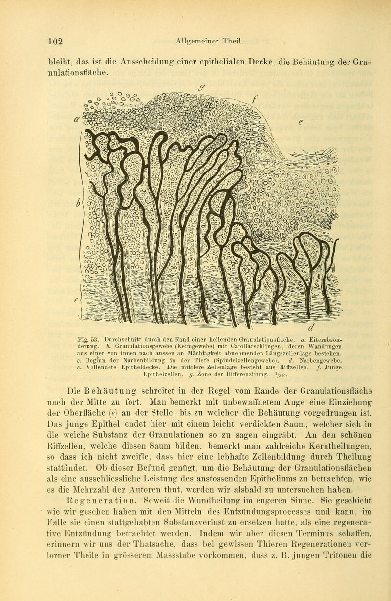 bleibt, das ist die Ausscheidung einer epithelialen Decke, die Behäutung der Gra- nulationsfläche. Fig. 53. Durchschnitt durch den Rand einer heilenden Grranulationsfläche. a. Eiterahson- derung. &. Granulationsgewehe (Keimgewehe) mit Capillarschlingen, deren Wandungen aus einer von innen nach aussen an Mächtigkeit annehmenden Längszellenlage bestehen. c. Beginn der Narhenhildung in der Tiefe (Spindelzellengewehe). d. Narhengewehe. e. Vollendete Epitheldecke. Die mittlere Zellenlage besteht aus Riffzellen. /. Junge Epithelzellen. </. Zone der Differenzirung. Vsoo- Die Behäutung schreitet in der Regel vom Rande der Granulationsfläche nach der Mitte zu fort. Man bemerkt mit unbewaffnetem Auge eine Einziehung der Oberfläche (e) an der Stelle, bis zu welcher die Behäutung vorgedrungen ist. Das junge Epithel endet hier mit einem leicht verdickten Saum, welcher sich in die weiche Substanz der Granulationen so zu sagen eingräbt. An den schönen Riffzellen, welche diesen Saum bilden, bemerkt man zahlreiche Kerntheilungen, so dass ich nicht zweifle, dass hier eine lebhafte Zellenbildung durch Theilung stattfindet. Ob dieser Befund genügt, um die Behäutung der Granulationsflächen als eine ausschliessliche Leistung des anstossenden Epitheliums zu betrachten, wie es die Mehrzahl der Autoren thut, werden wir alsbald zu untersuchen haben. Regeneration. Soweit die Wundheilung im engeren Sinne. Sie geschieht Avie wir gesehen haben mit den Mitteln des Entziindungsprocesses und kann, im Falle sie einen stattgehabten Substanzverlust zu ersetzen hatte, als eine regenera- tive Entzündung betrachtet werden. Indem wir aber diesen Terminus schaffen, erinnern wir uns der Thatsache, dass bei gewissen Thieren Regenerationen ver- lorner Theile in grösserem Massstabe vorkommen, dass z. B. jungen Tritonen die