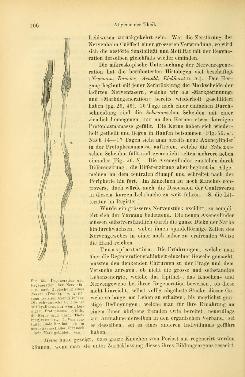 Leidwesen zurückgekehrt sein. War die Zerstörung der Nervenbahn Coeffect einer grösseren Verwundung, so wird sich die gestörte Sensibilität und Motilität mit der Regene- ration derselben gleichfalls wieder einfinden. Die mikroskopische Untersuchung der Nervenregene- ration hat die berühmtesten Histologen viel beschäftigt [Neumann, Ranvier, Arnold, Eichhorst u. A.). Der Her- gang beginnt mit jener Zerbröcklung der Markscheide der lädirten Nervenfasern, welche wir als »Markgerinnung« und »Markdegeneration« bereits wiederholt geschildert haben (pg. 26, 46). 10 Tage nach einer einfachen Durch- schneidung sind die Scfavannscken Scheiden mit einer ziemlich homogenen, nur an den Kernen etwas körnigen Protoplasmamasse gefüllt. Die Kerne haben sich wieder- holt getheilt und liegen in Haufen beisammen (Fig. 56. a . Nach 14—17 Tagen sieht man bereits neue Axencylinder in der Protoplasmamasse auftreten, welche die Schivann- schen Scheiden füllt und zwar nicht selten mehrere neben einander (Fig. 56. b). Die Axencylinder entstehen durch Differenzirung, die Differenzirung aber beginnt im Allge- meinen an dem centralen Stumpf und schreitet nach der Peripherie hin fort. Im Einzelnen ist noch Manches con- trovers, doch würde auch die Discussion der Controverse in diesem kurzen Lehrbuche zu weit führen. (S. die Lit- teratur im Register.) Wurde ein grösseres Nervenstück excidirt, so compli- cirt sich der Vorgang bedeutend. Die neuen Axencylinder müssen selbstverständlich durch die ganze Dicke der Narbe hindurchwachsen, wobei ihnen spindelförmige Zellen des Nervengewebes in einer noch näher zu eruirenden Weise die Hand reichen. Transplantation. Die Erfahrungen, welche man über die Regenerationsfähigkeit einzelner Gewebe gemacht, mussten den denkenden Chirurgen zu der Frage und dem Versuche anregen, ob nicht die grosse und selbständige Lebensenergie, welche das Epithel-, das Knochen- und Nervengewebe bei ihrer Regeneration beweisen, ob diese nicht hinreicht, selbst völlig abgelöste Stücke dieser Ge- webe so lange am Leben zu erhalten, bis möglichst gün- stige Bedingungen, welche man für ihre Ernährung an einem ihnen übrigens fremden Orte bereitet, neuerdings zur Aufnahme derselben in den organischen Verband, sei es desselben, sei es eines anderen Individuums geführt haben. Heine hatte gezeigt, dass ganze Knochen vom Periost aus regenerirt werden können wenn man sie unter Zurücklassimg dieses ihres Bildungsorgans resecirt. Fig. 56. Degeneration und Regeneration der Nervenfa- sern nacli Quetschung eines Nerven (Frosch), a. Auflö- sung des alten Axencylinders. Die Schwannsche Scheide ist mit hyalinem, nur wenig kör- nigem Protoplasma gefüllt, die Kerne sind durch Thei- lung', vermehrt. 6. Vom cen- tralen Ende her hat sich ein neuer Axencylinder, aber noch ^ein Mark gebildet, Vsoo-